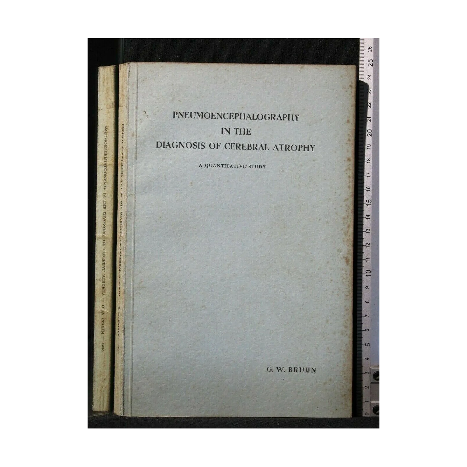 PNEUMOENCEPHALOGRAPHY IN THE DIAGNOSIS OF CEREBRAL ATROPHY
