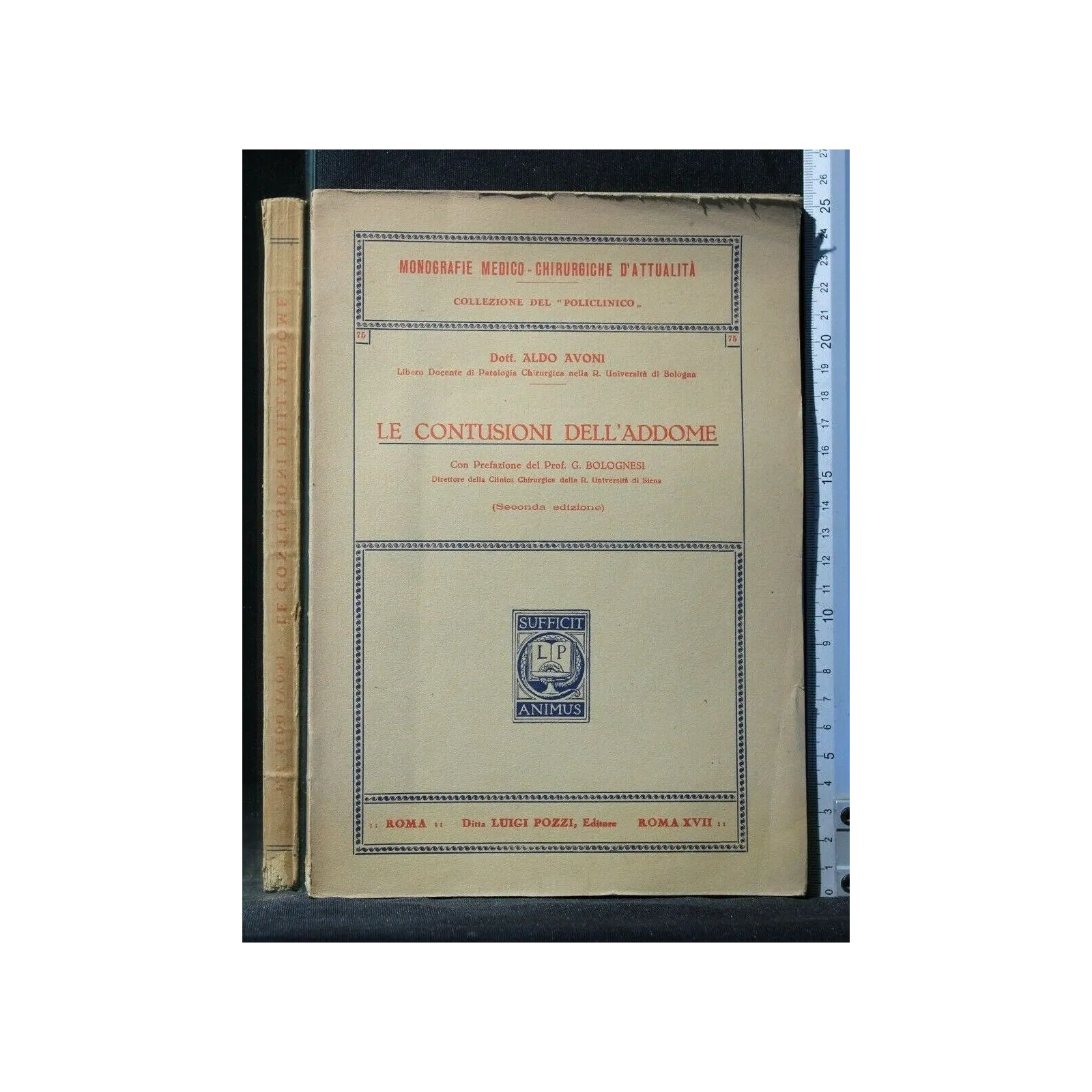 LE CONTUSIONI DELL'ADDOME