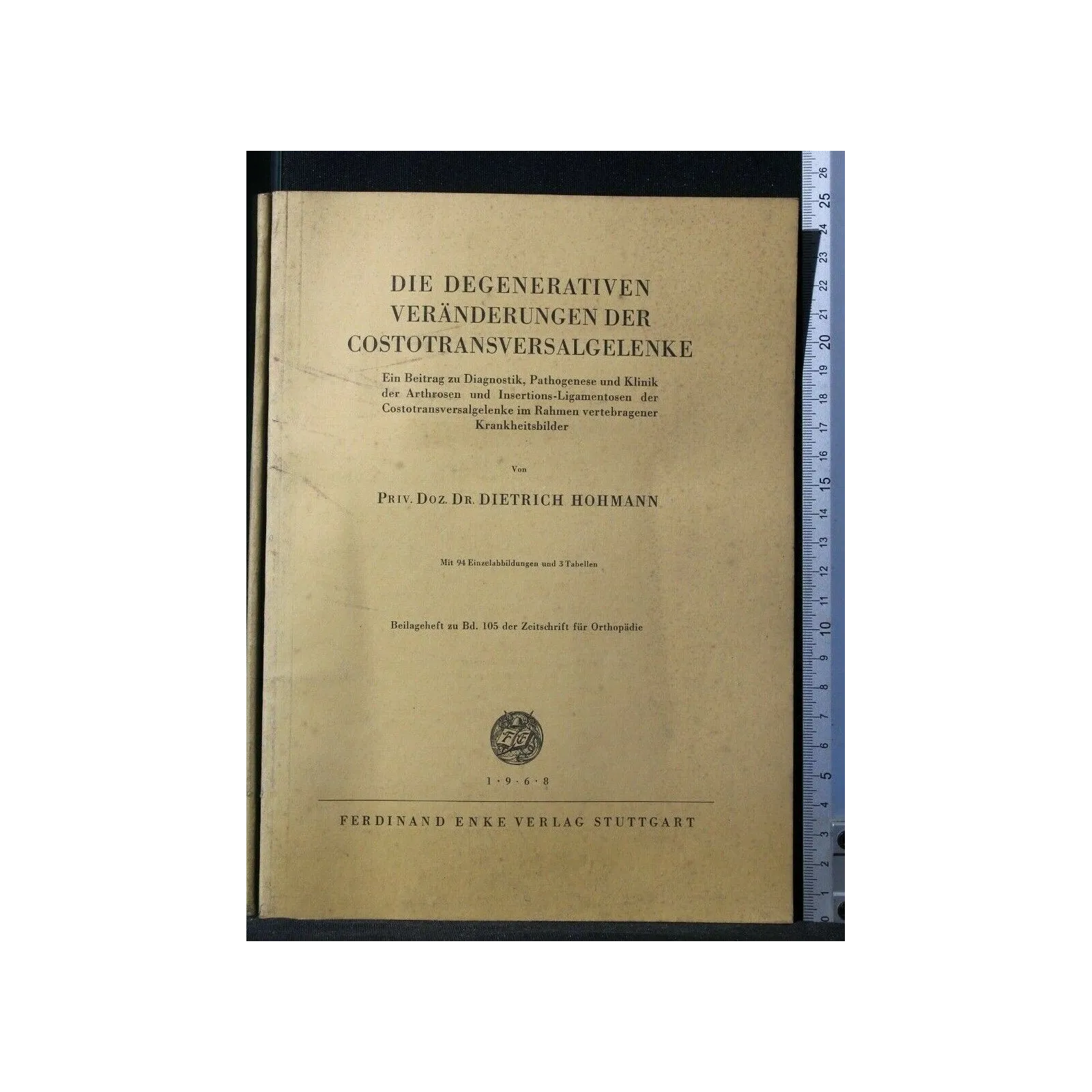 MISSERFOLGE UND BESCHWERDEN NACH GALLENSTEINOPERATIONEN