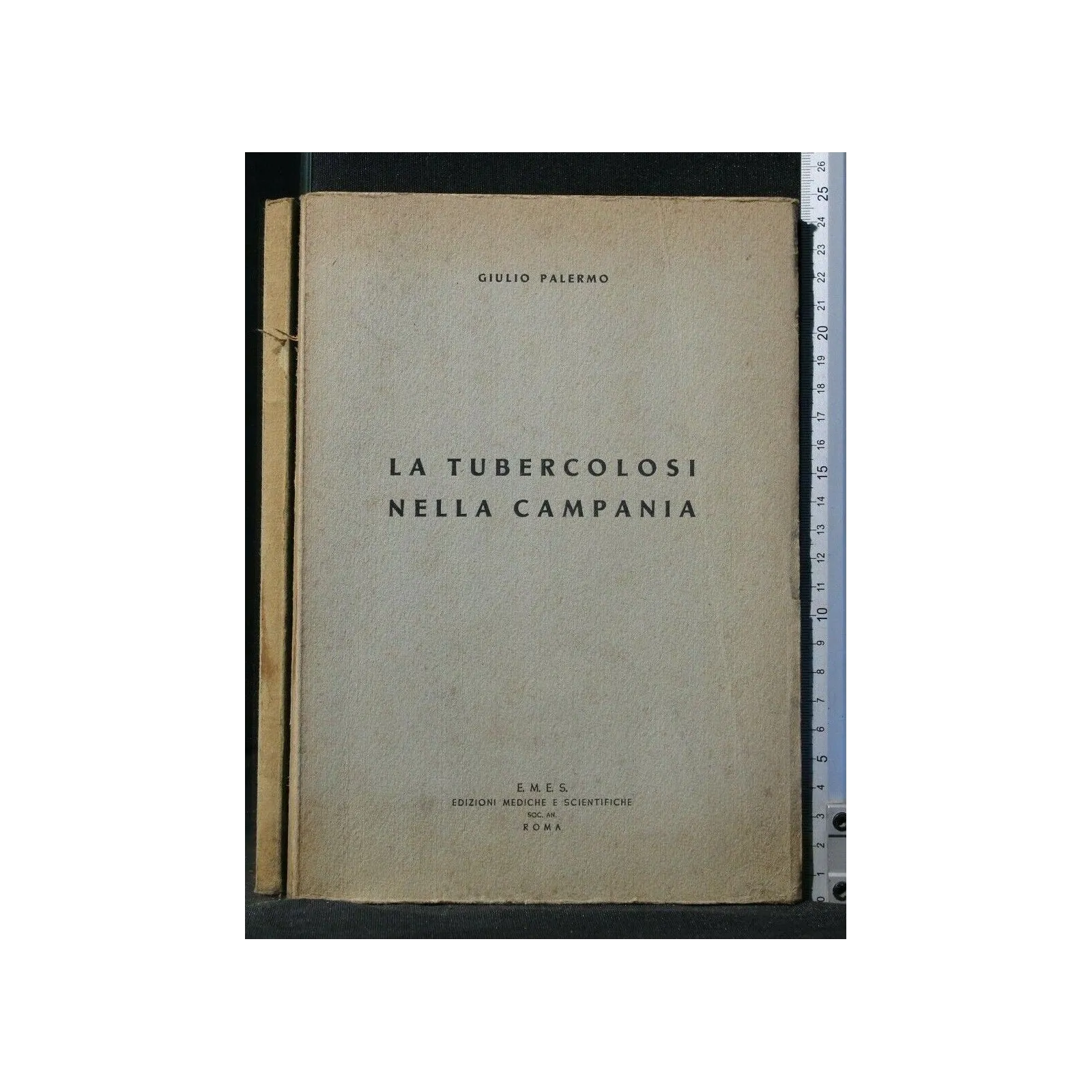 LA TUBERCOLOSI NELLA CAMPANIA