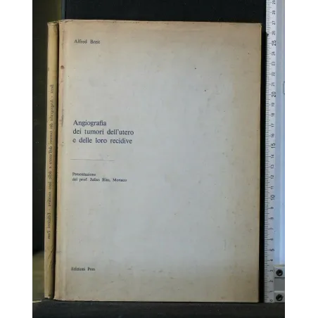 ANGIOGRAFIA DEI TUMORI DELL'UTERO E DELLE LORO RECIDIVE