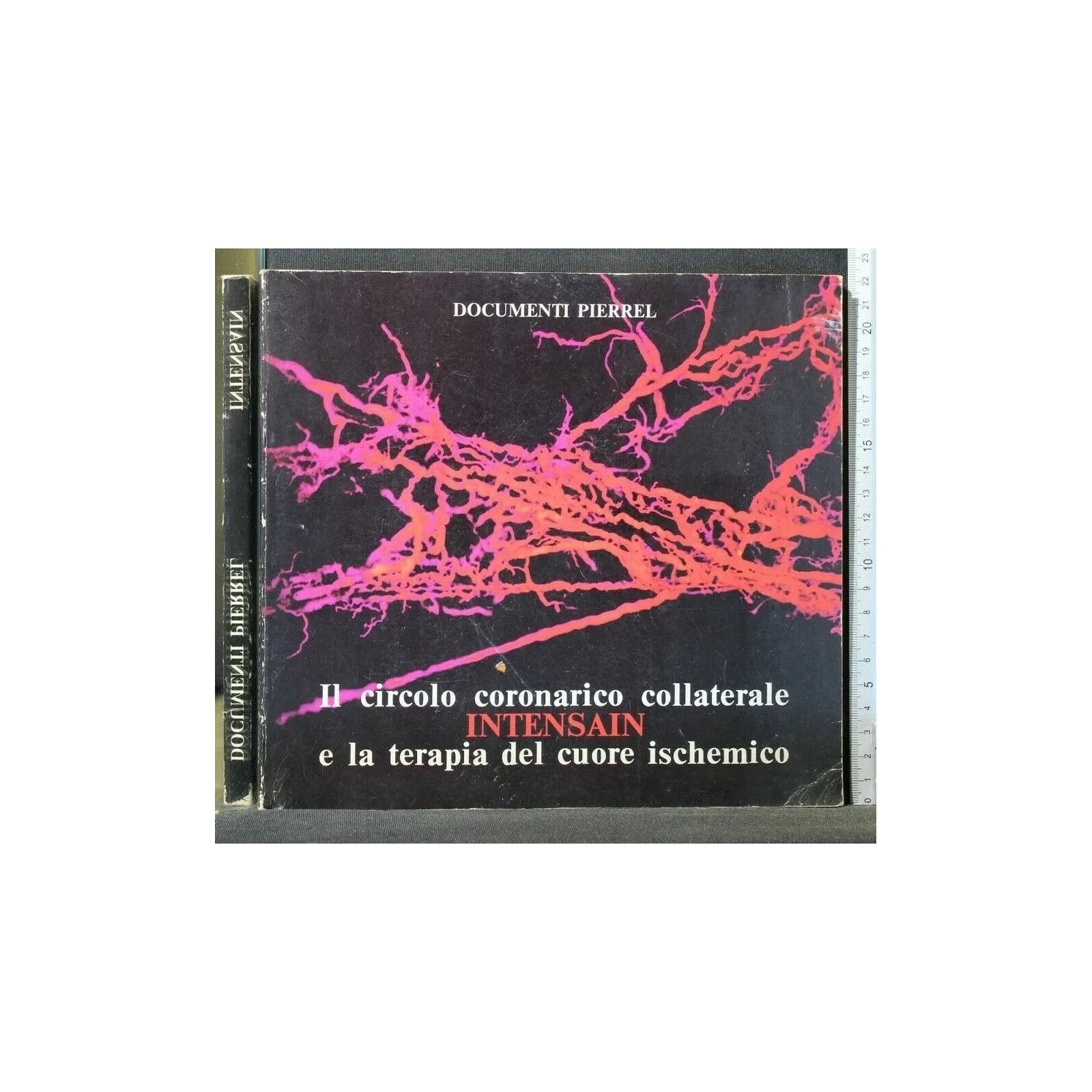 IL CIRCOLO CORONARICO COLLATERALE E LA TERAPIA DEL CUORE