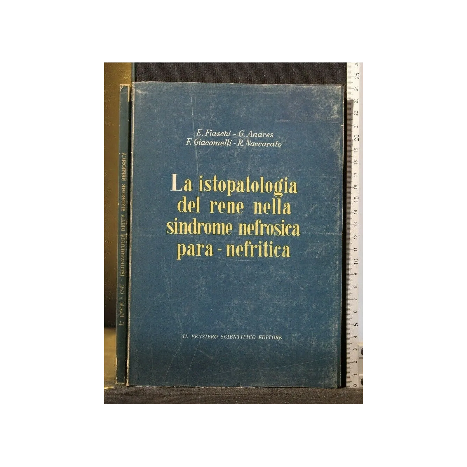 LA ISTOPATOLOGIA DEL RENE NELLA SINDROME NEFROSICA