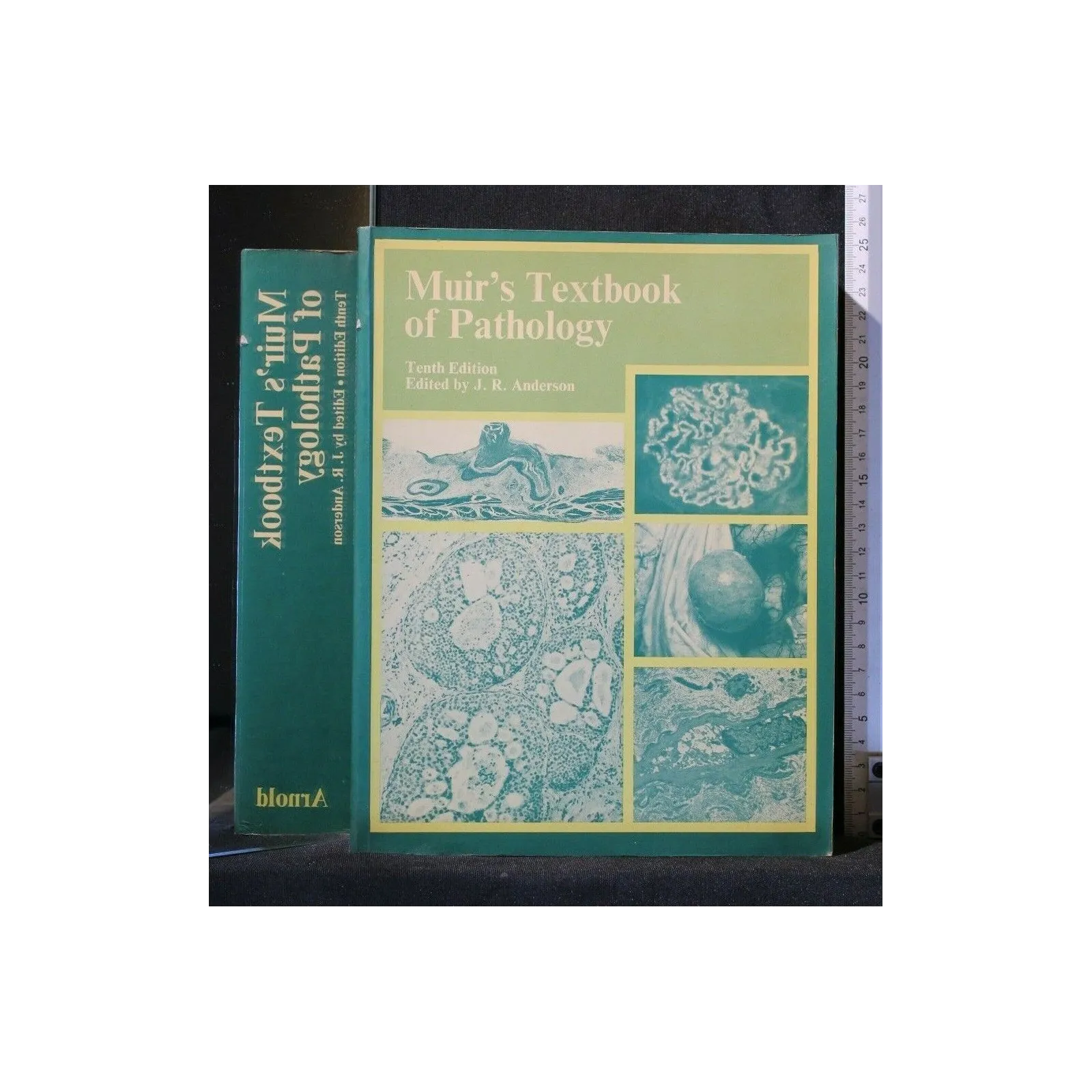MUIR'S TEXTBOOK OF PATHOLOGY
