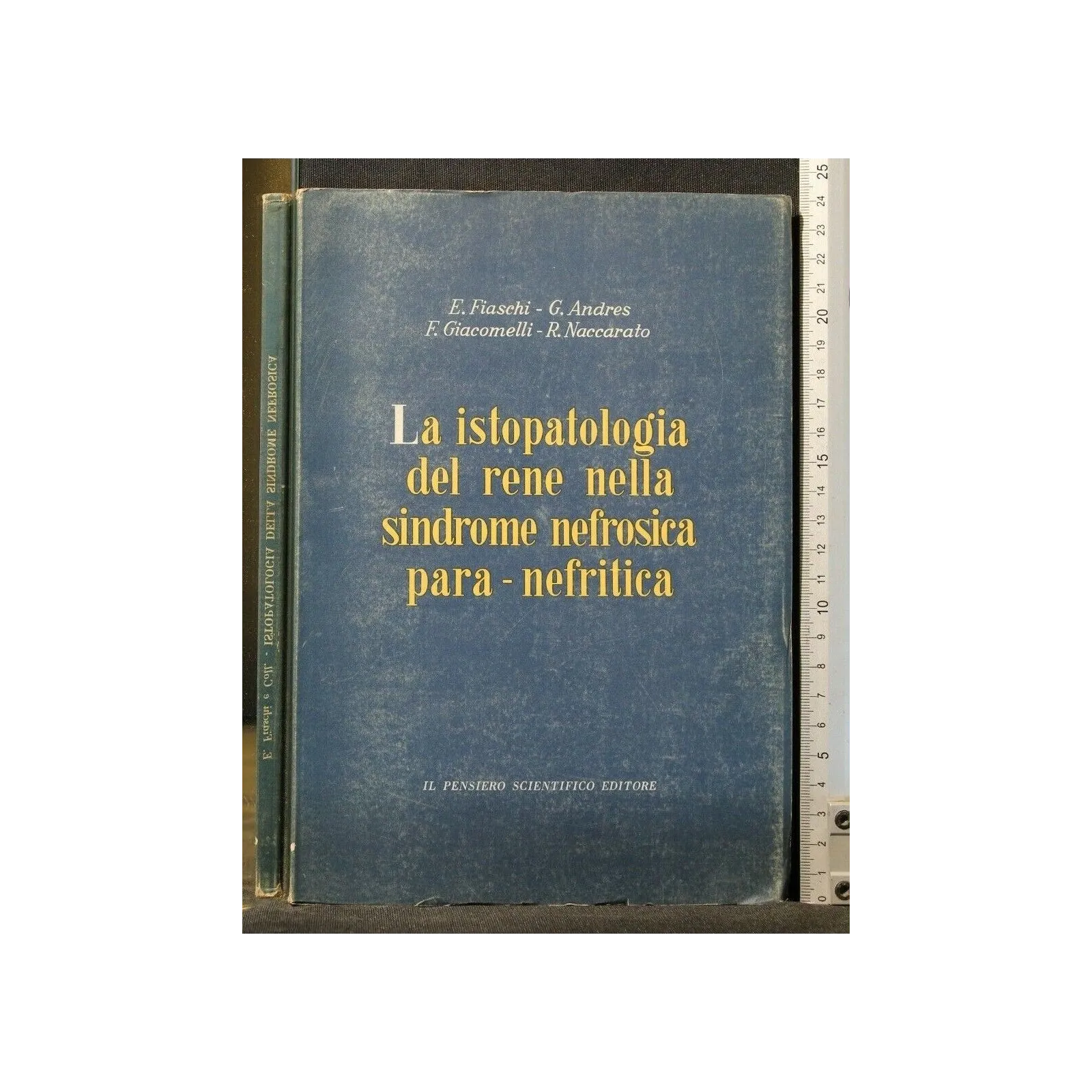 LA ISTOPATOLOGIA DEL RENE NELLA SINDROME NEFROSICA