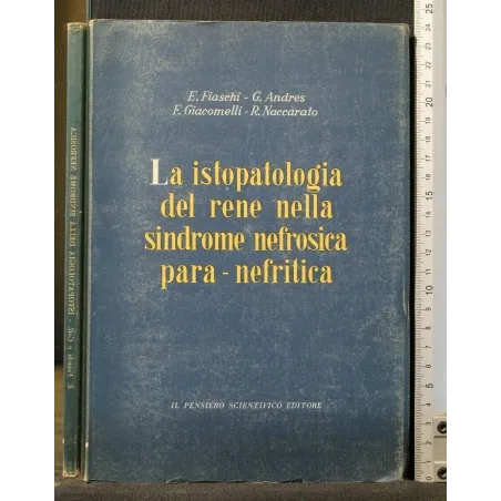 LA ISTOPATOLOGIA DEL RENE NELLA SINDROME NEFROSICA