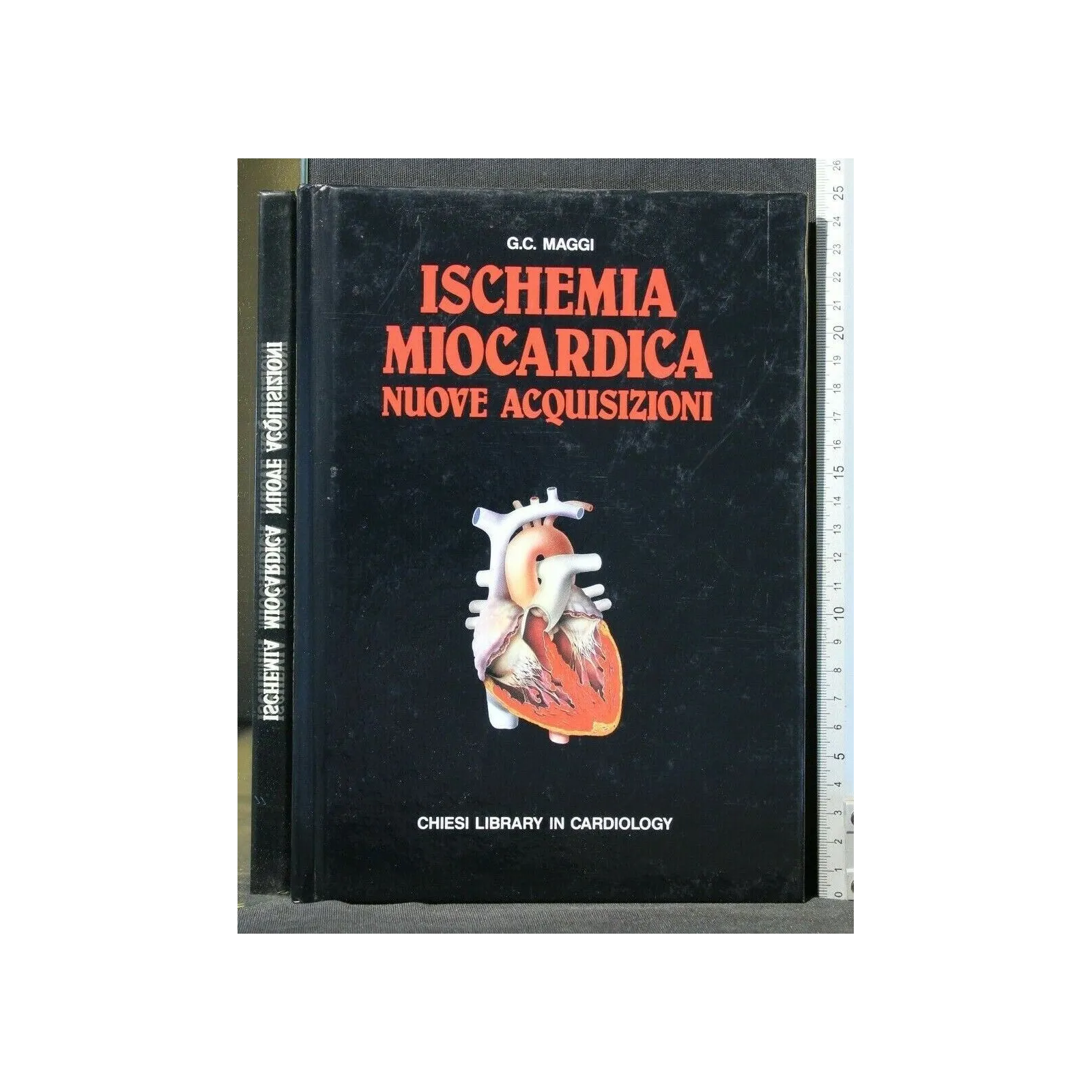 ISCHEMIA MIOCARDICA NUOVE ACQUISIZIONI