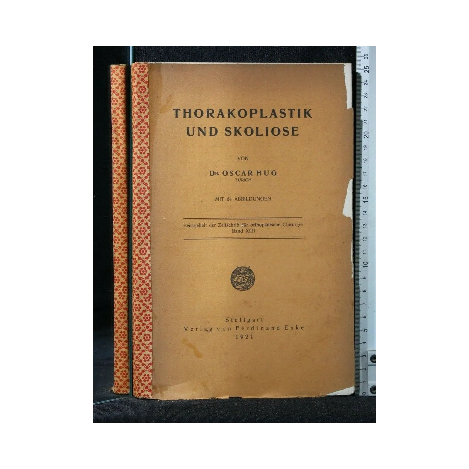 THORAKOPLASTIK UND SKOLIOSE