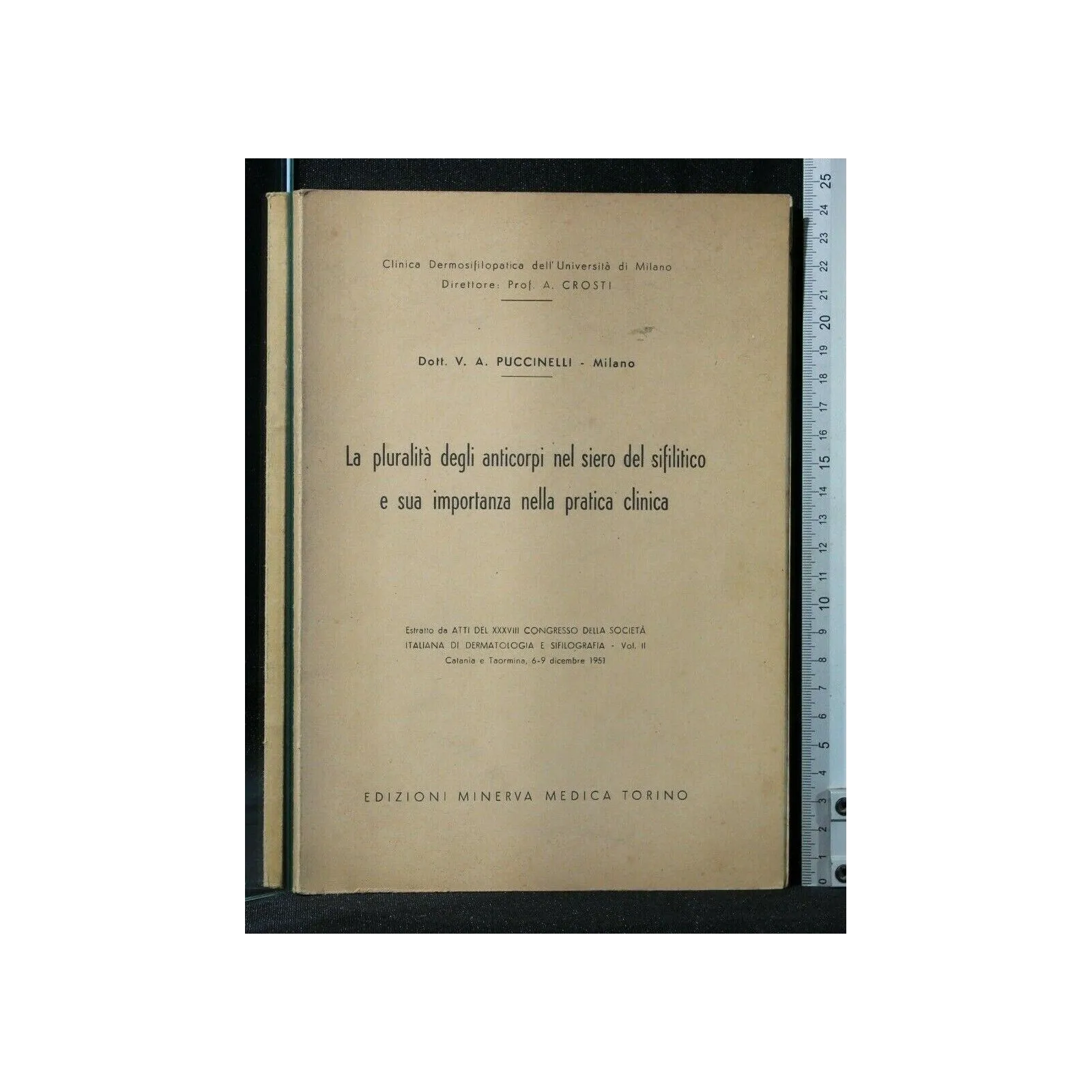 LA PLURALITA' DEGLI ANTICORPI NEL SIERO DEL SIFILITICO E SUA
