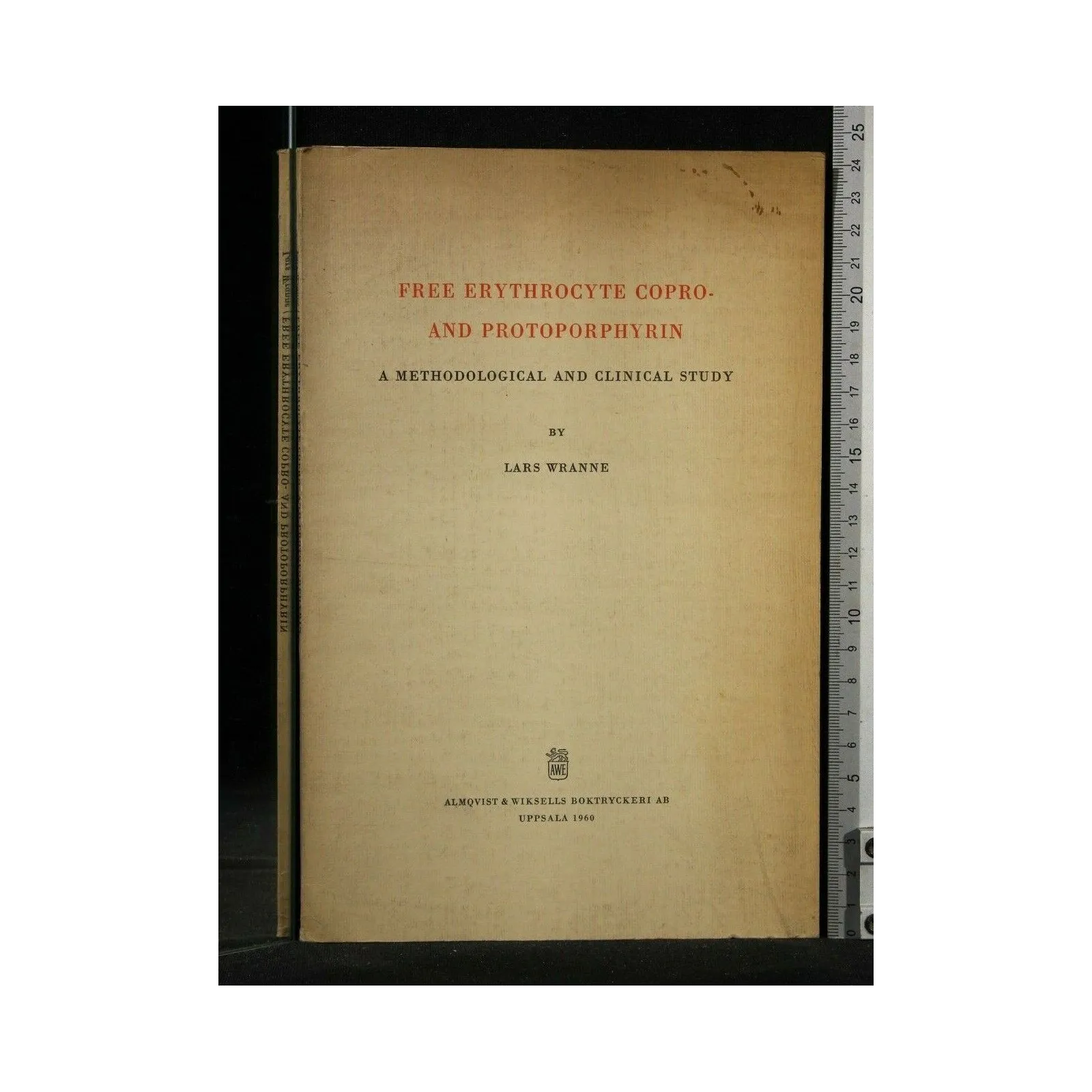 FREE ERYTHROCYTE COPRO AND PROTOPORPHYRIN