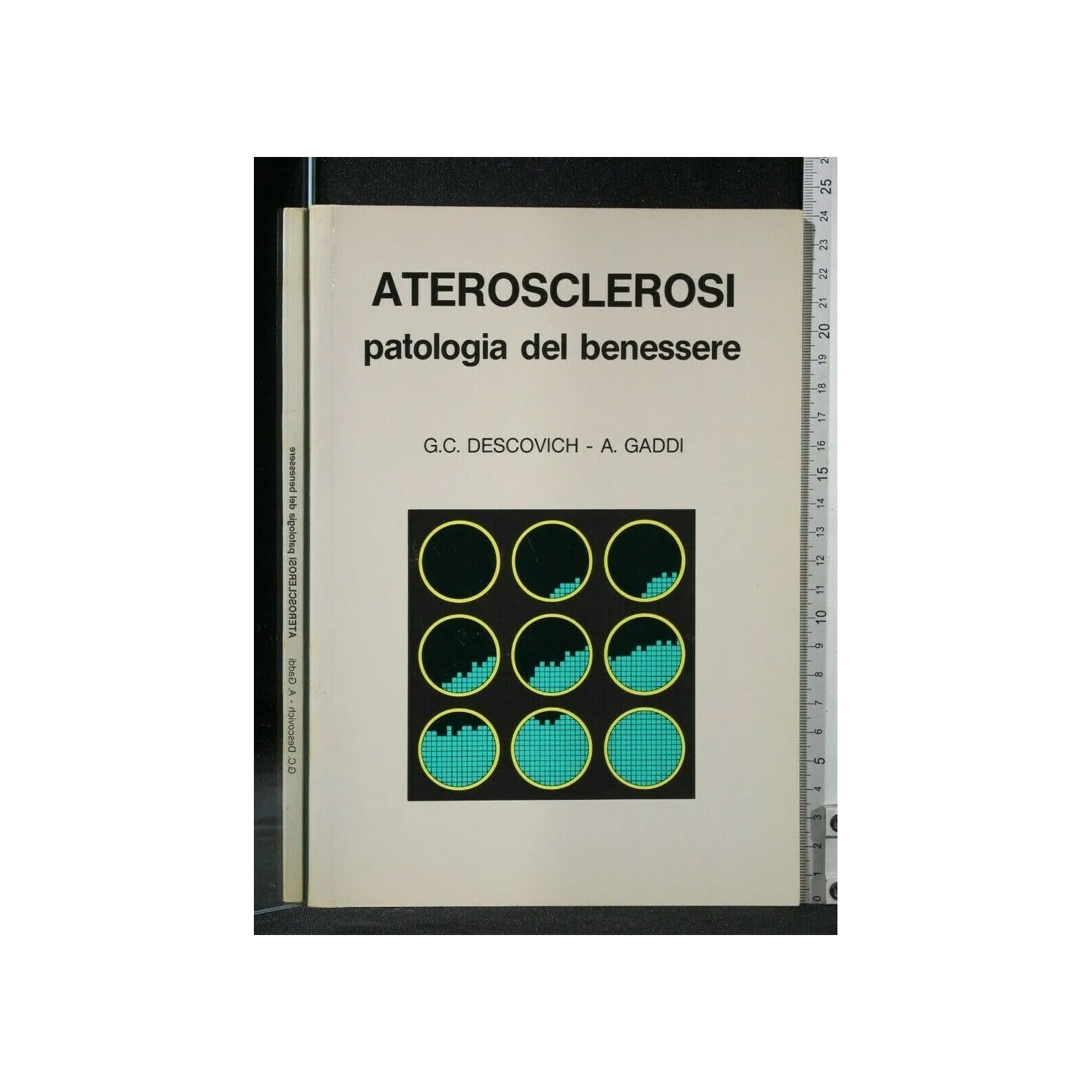 ATEROSCLEROSI PATOLOGIA DEL BENESSERE