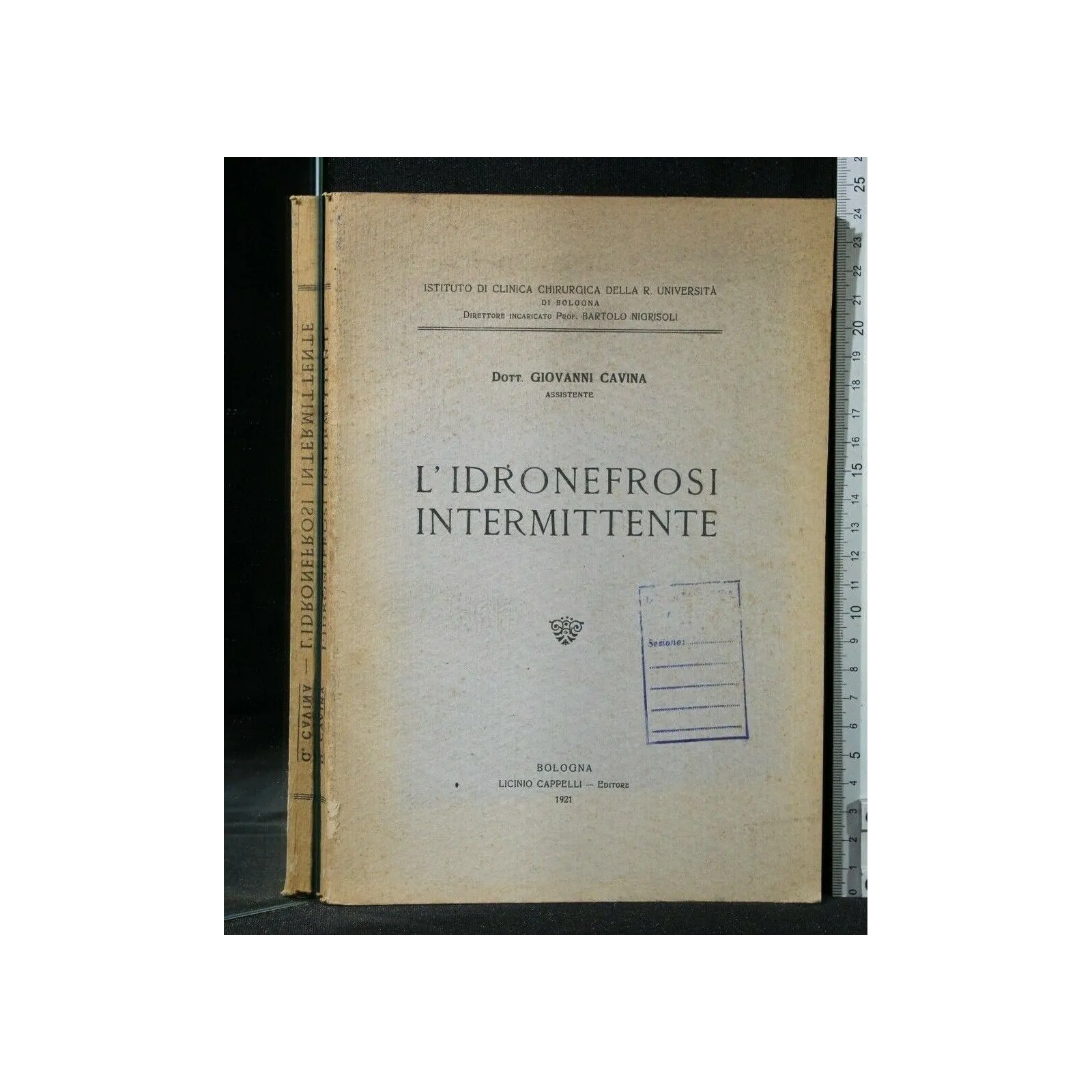 L'IDRONEFROSI INTERMITTENTE