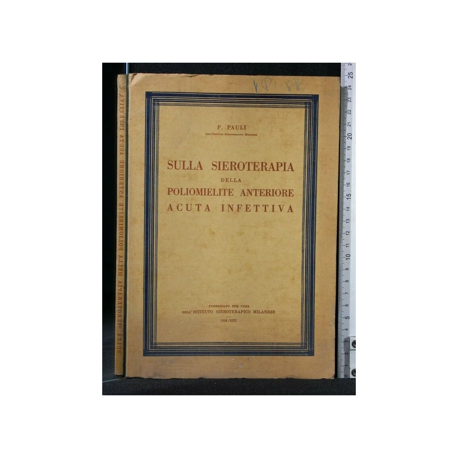 SULLA SIEROTERAPIA DELLA POLIOMELITE ANTERIORE ACUTA INFETTIVA