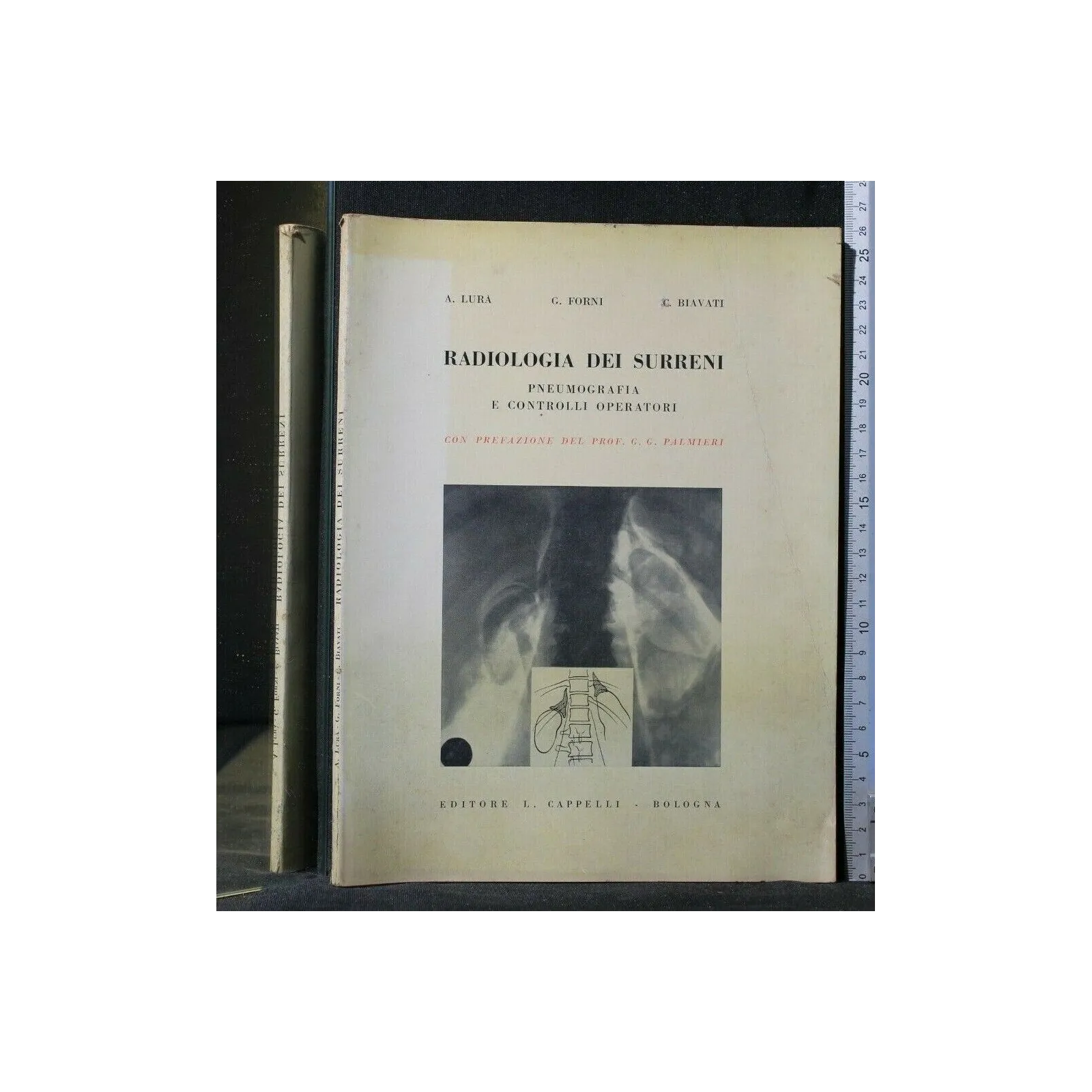 RADIOLOGIA DEI SURRENI PNEUMOGRAFIA E CONTROLLI OPERATORI