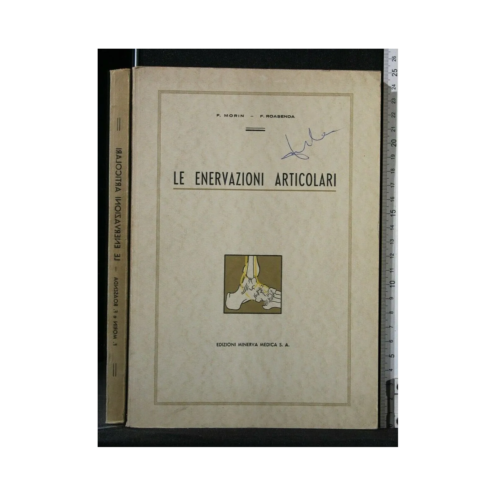 LE ENERVAZIONI ARTICOLARI