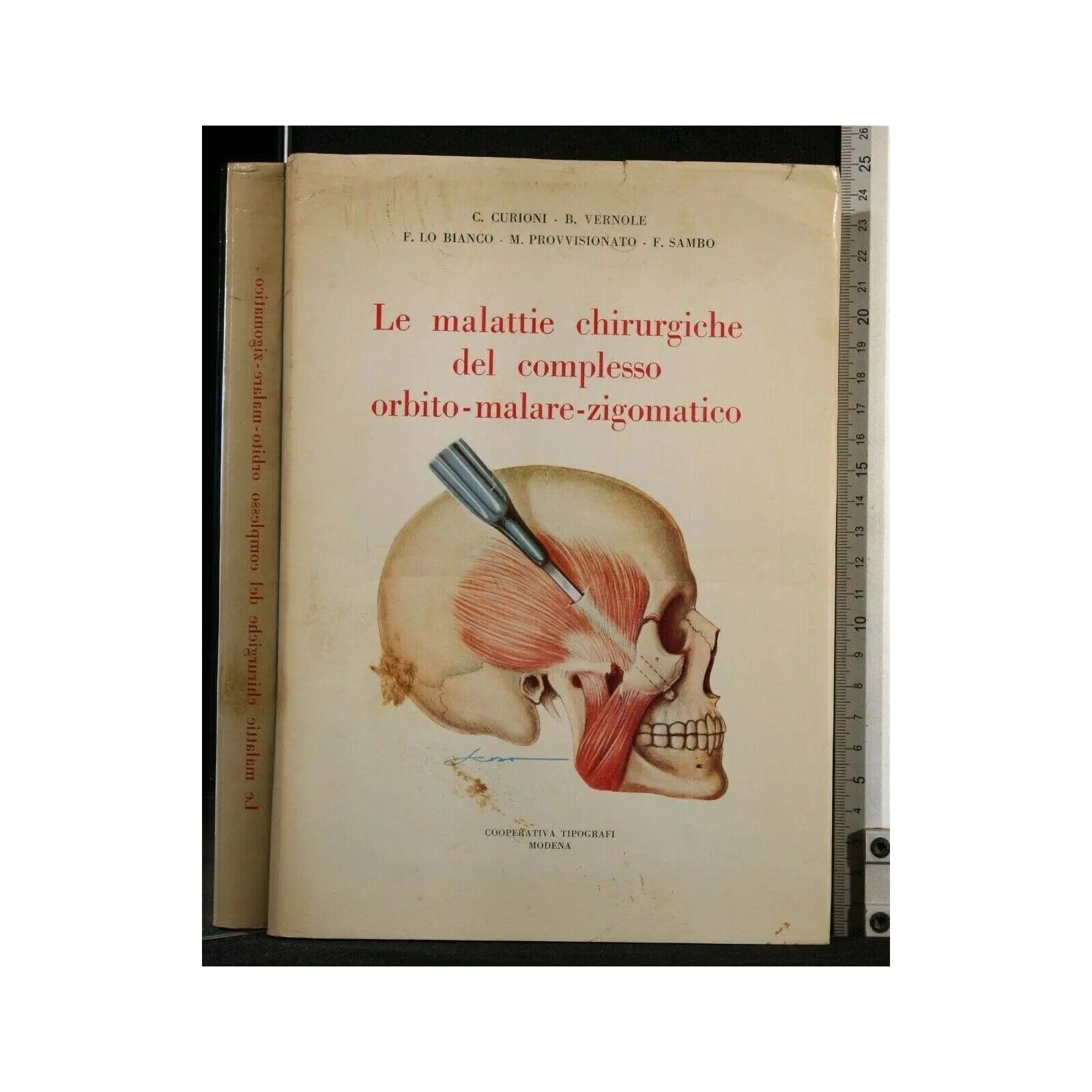 LE MALATTIE CHIRURGICHE DEL COMPLESSO ORBITO-MALARE-ZIGOMATICO