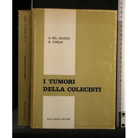 I TUMORI DELLA COLECISTI