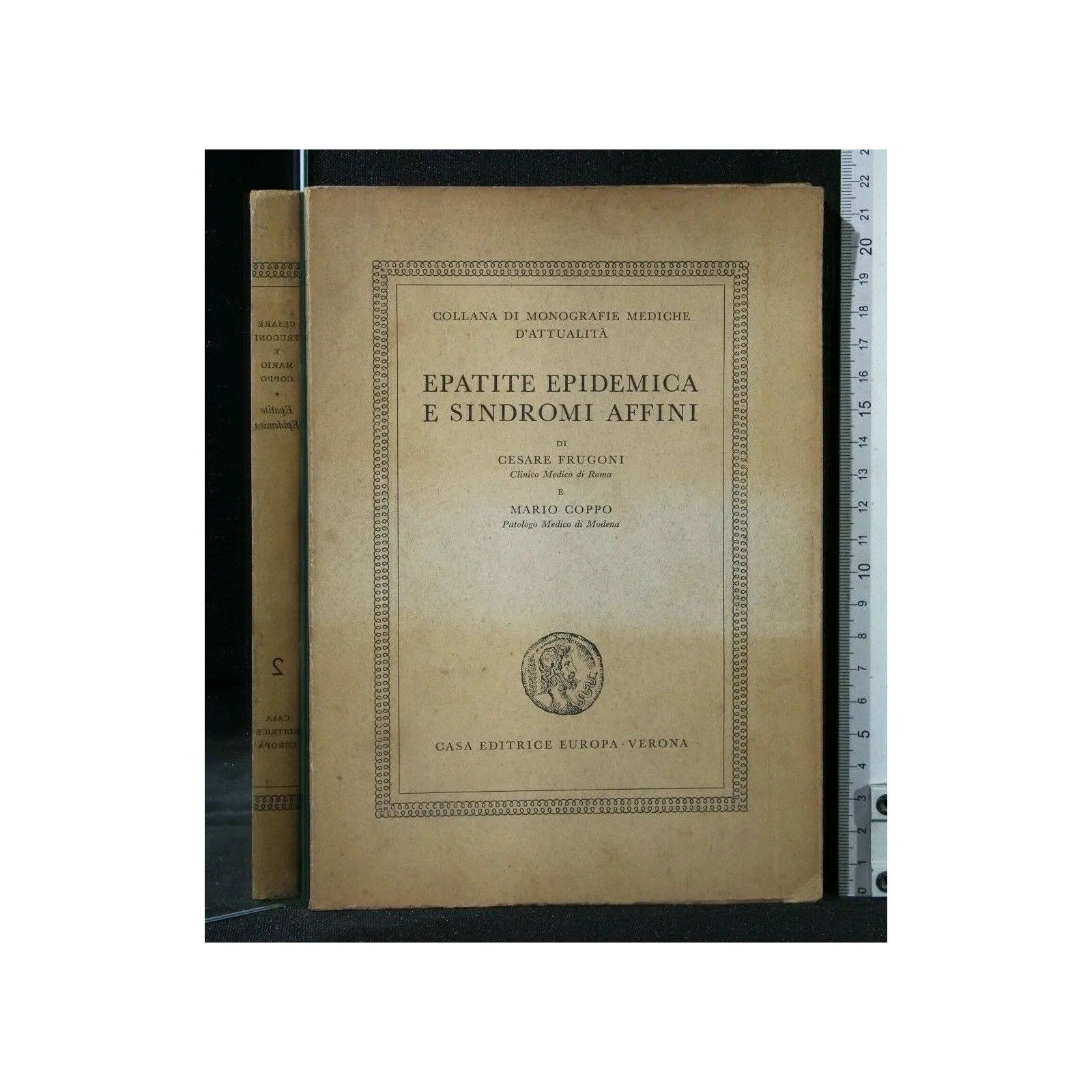 EPATITE EPIDEMICA E SINDROMI AFFINI