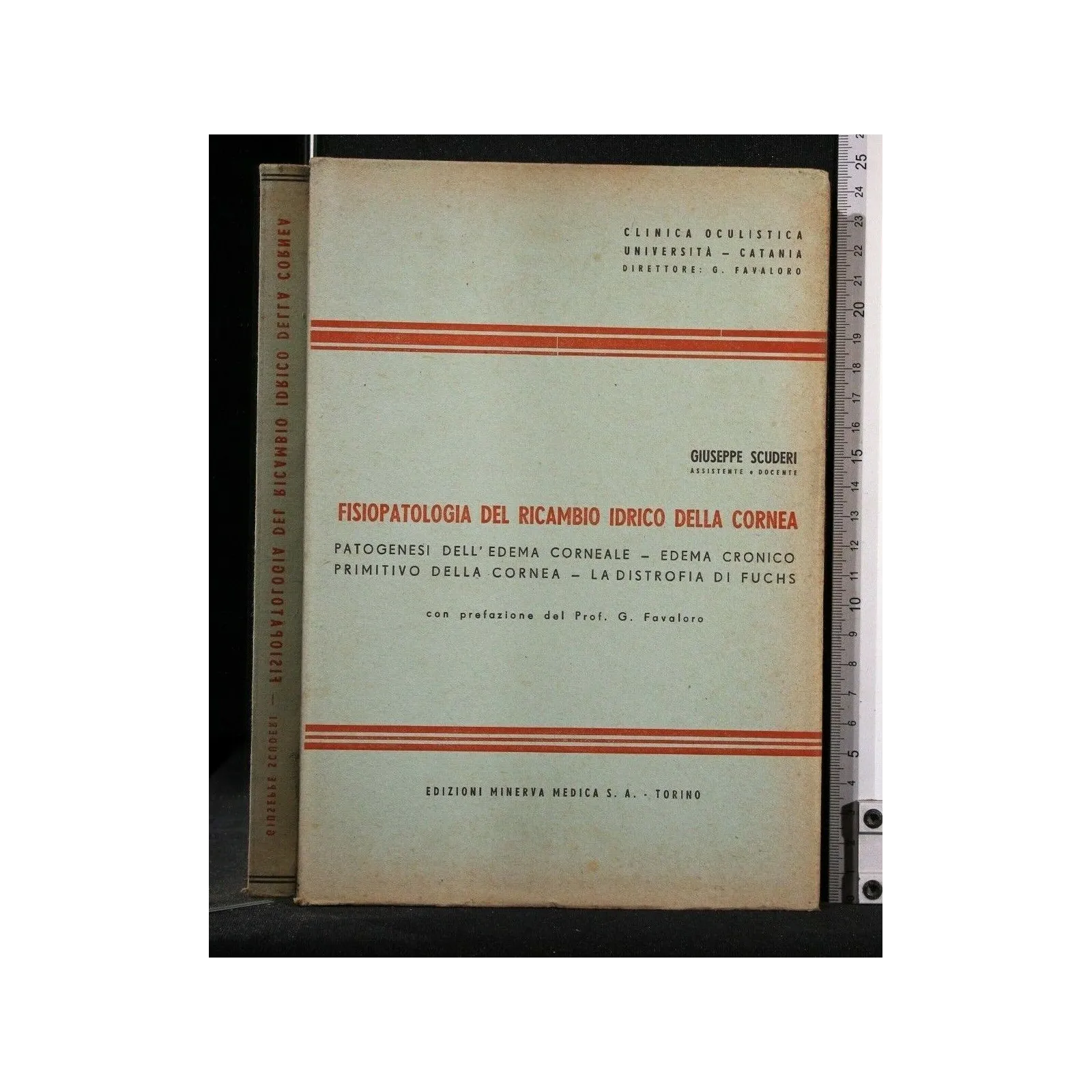 FISIOPATOLOGIA DEL RICAMBIO IDRICO DELLA CORNEA