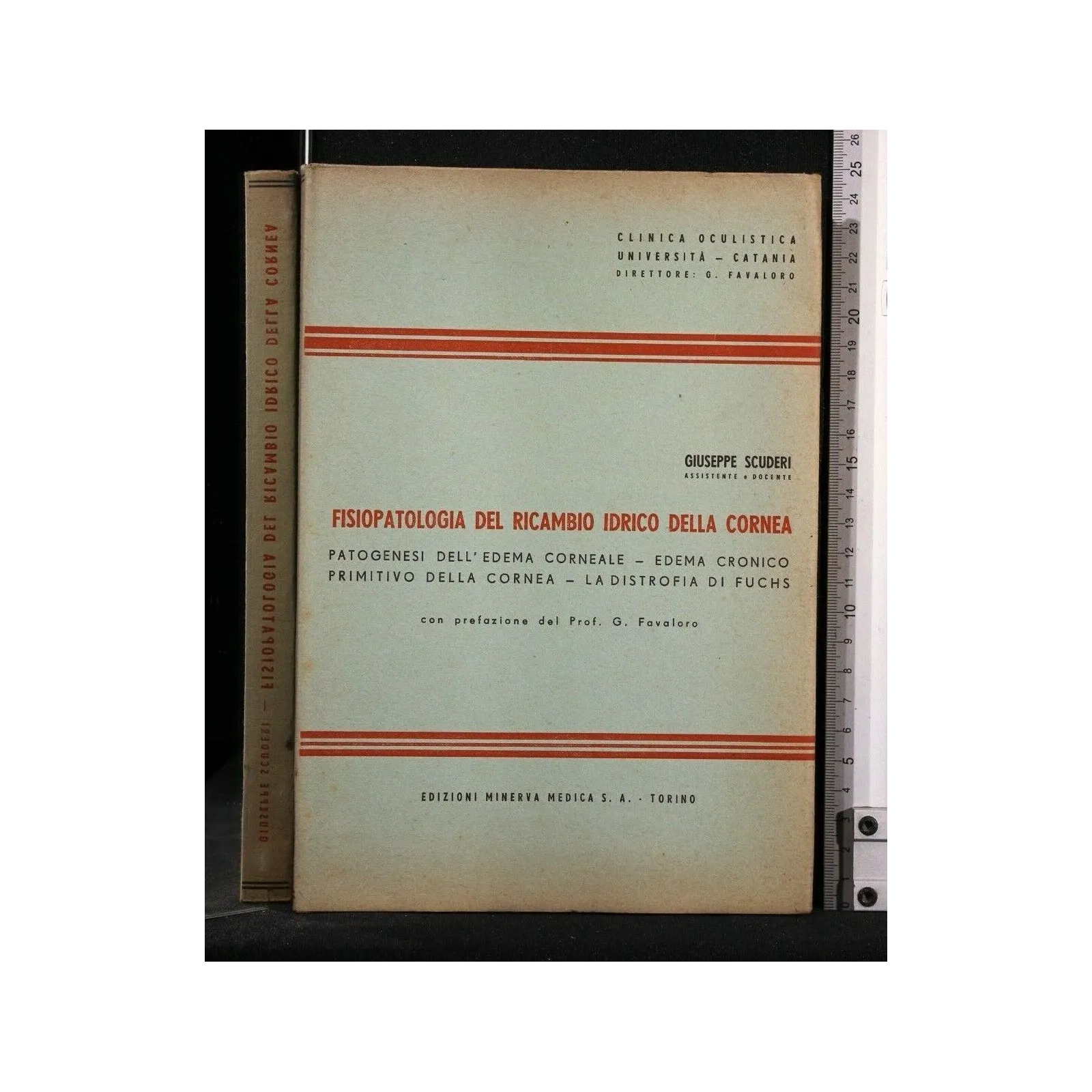 FISIOPATOLOGIA DEL RICAMBIO IDRICO DELLA CORNEA