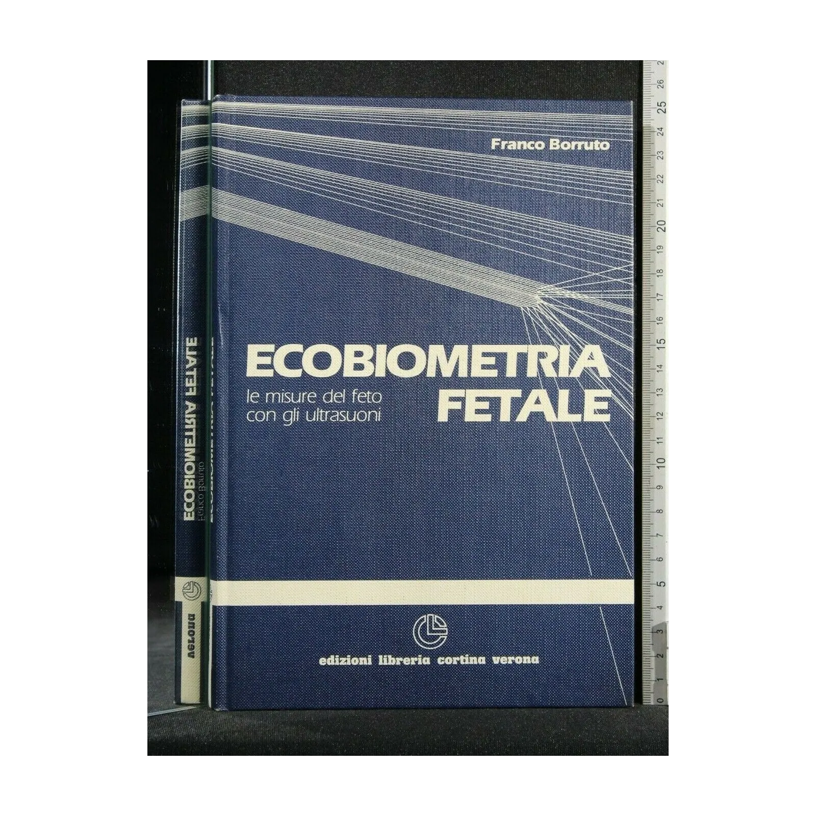ECOBIOMETRIA FETALE LE MISURE DEL FETO CON GLI ULTRASUONI