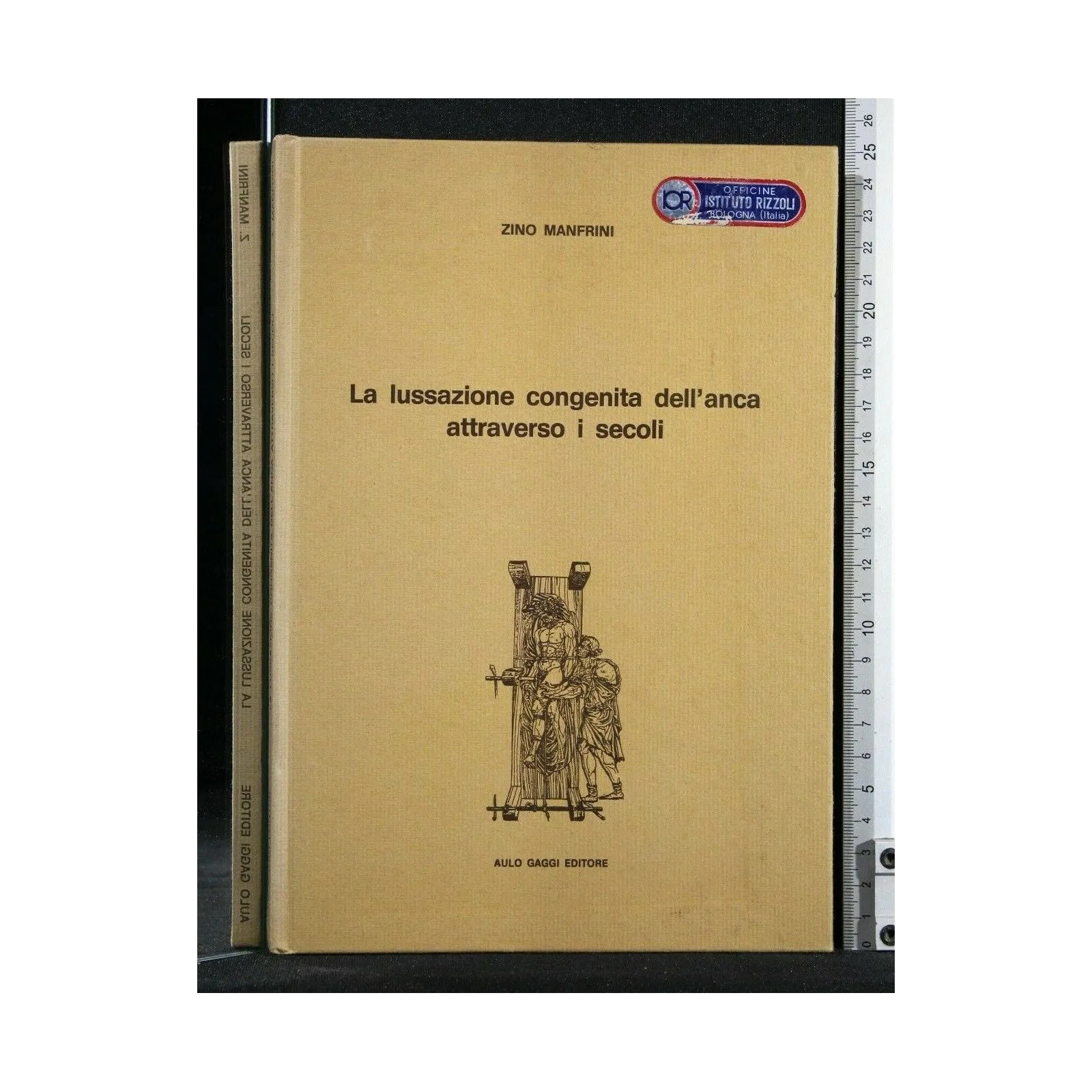 LA LUSSAZIONE CONGENITA DELL'ANCA ATTRAVERSO I SECOLI