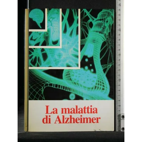 LA MALATTIA DI ALZHEIMER _x000D_
