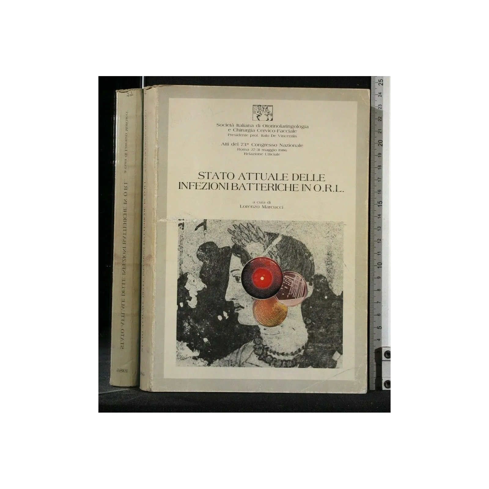 STATO ATTUALE DELLE INFEZIONI BATTERICHE IN O.R.L.