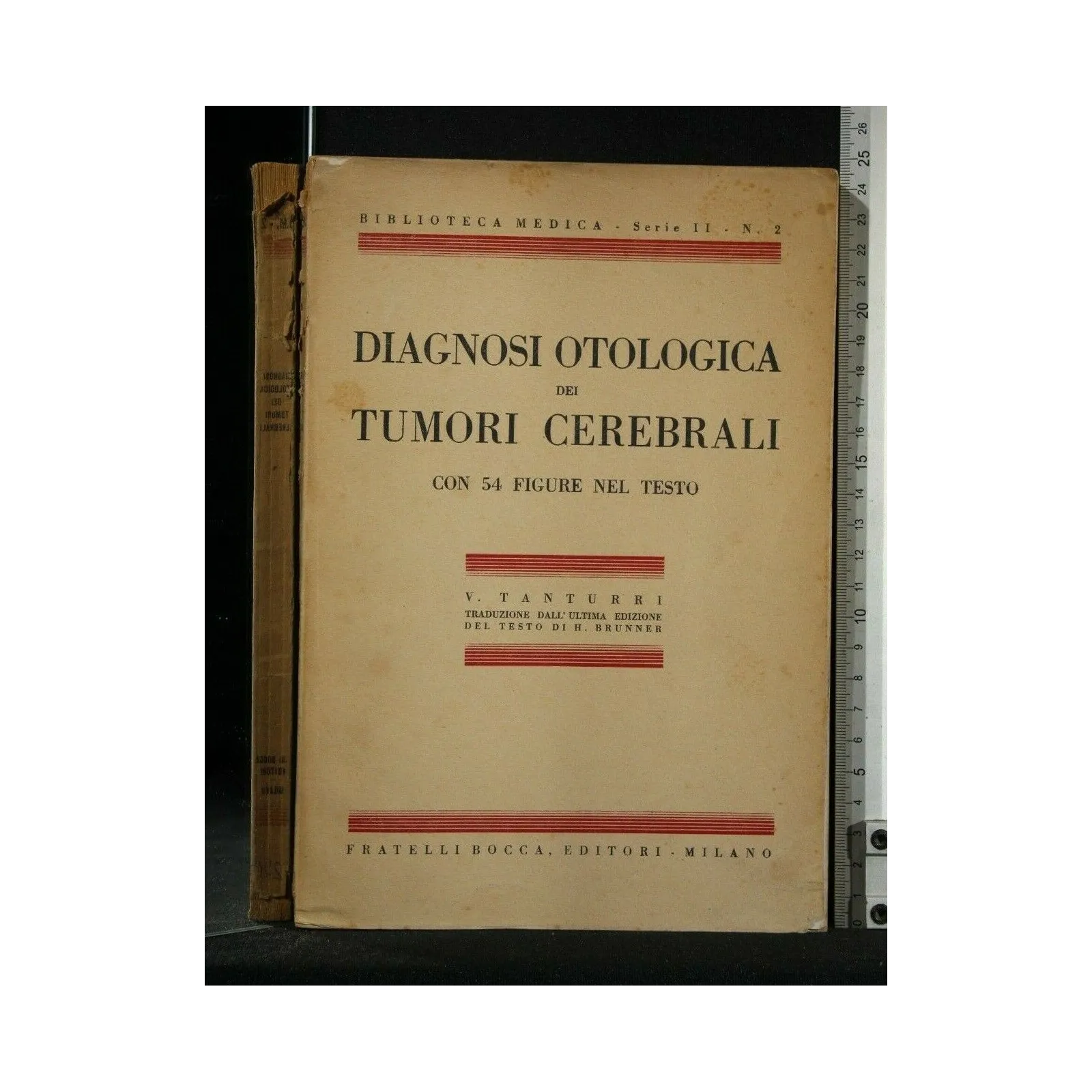 DIAGNOSI OTOLOGICA DEI TUMORI CEREBRALI