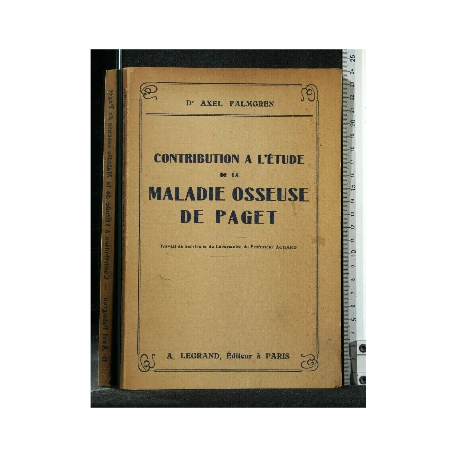 CONTRIBUTION A L'ETUDE DE LA MALADIE OSSEUSE DE PAGET