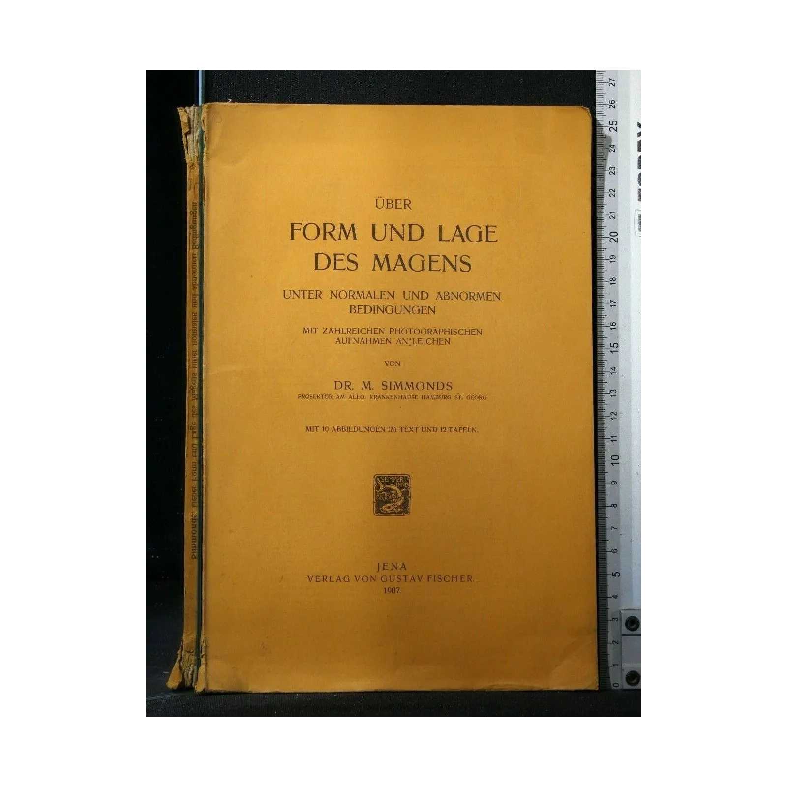 UBER FORM UND LAGE DES MAGENS