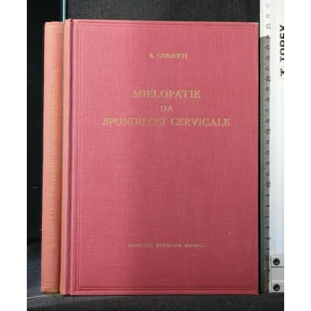 MIELOPATIE DA SPONDILOSI CERVICALE