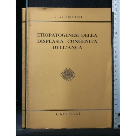 ETIOPATOGENESI DELLA DISPLASIA CONGENITA DELL'ANCA