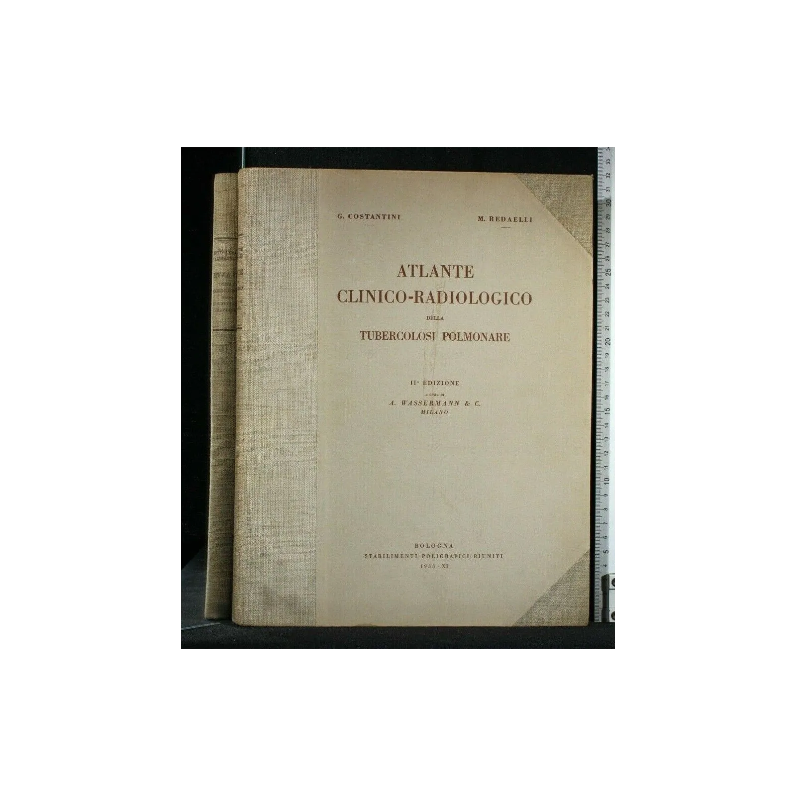 ATLANTE CLINICO-RADIOGRAFICO DELLA TUBERCOLOSI POLMONARE