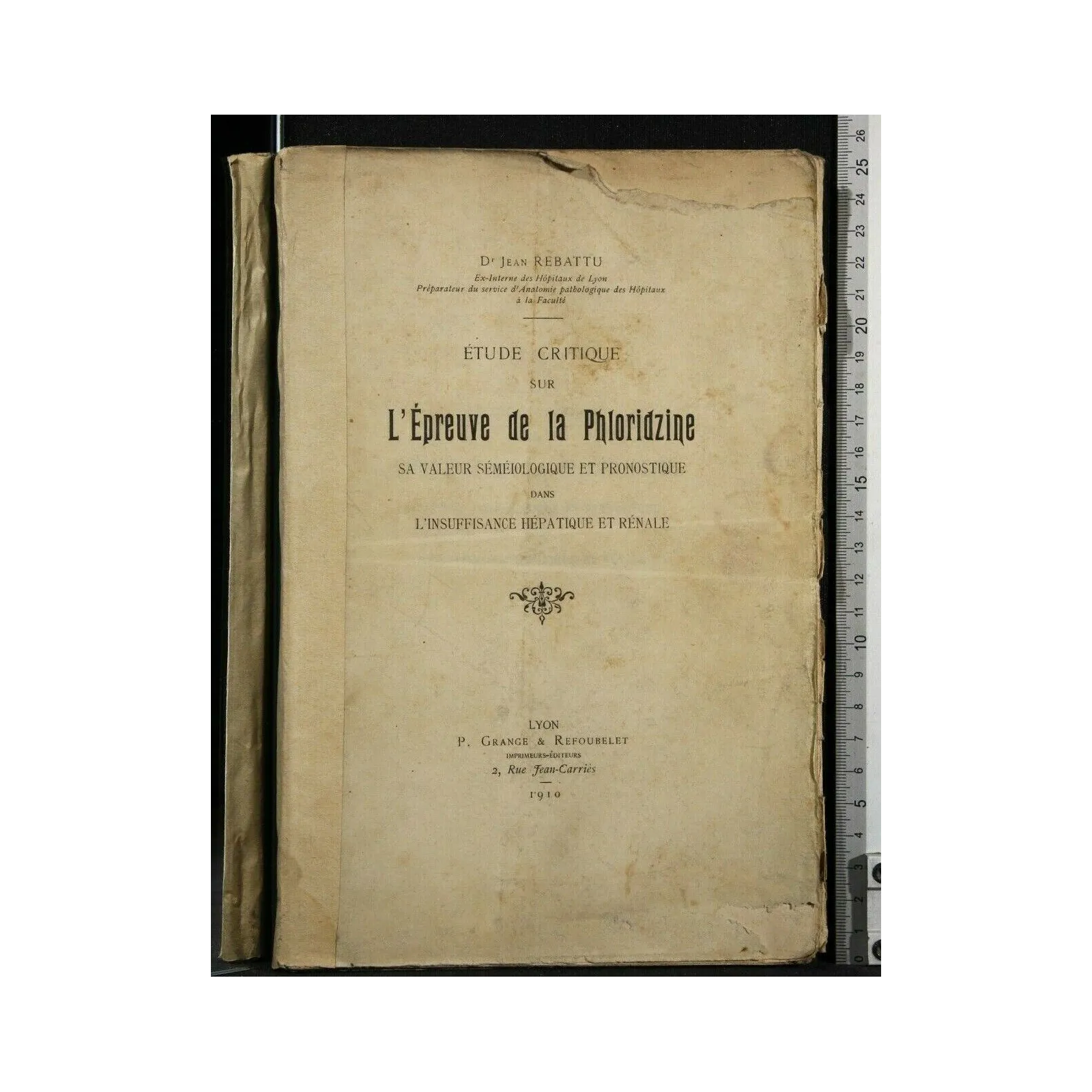 ETUDE CRITIQUE SUR L'EPREUVE DE LA PHLORIDZINE
