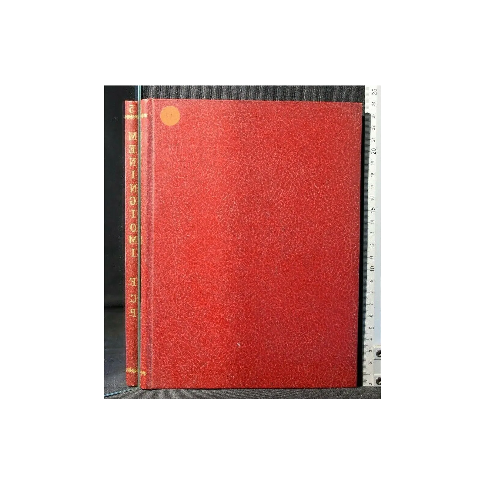 LES MENINGIOMES DE LA FOSSE CEREBRALE POSTERIEURE