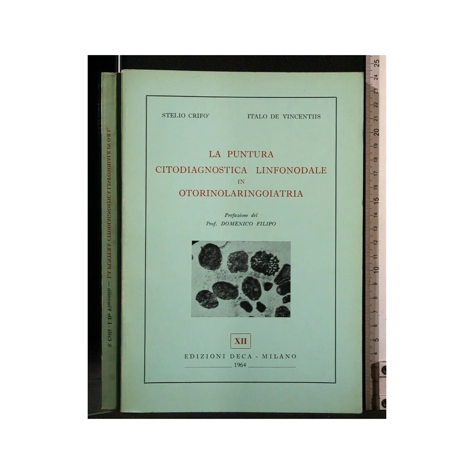 LA PUNTURA CITODIAGNOSTICA LINFONODALE IN OTORINOLARINGOIATRIA