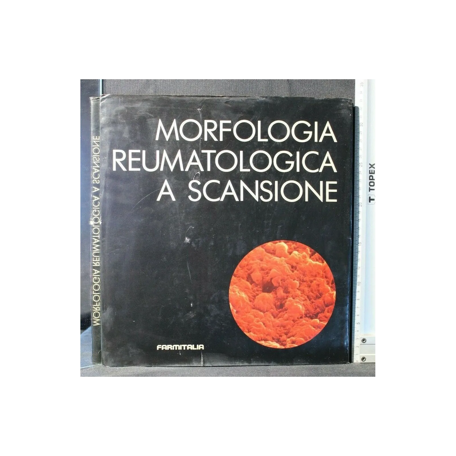 MORFOLOGIA REUMATOLOGICA A SCANSIONE