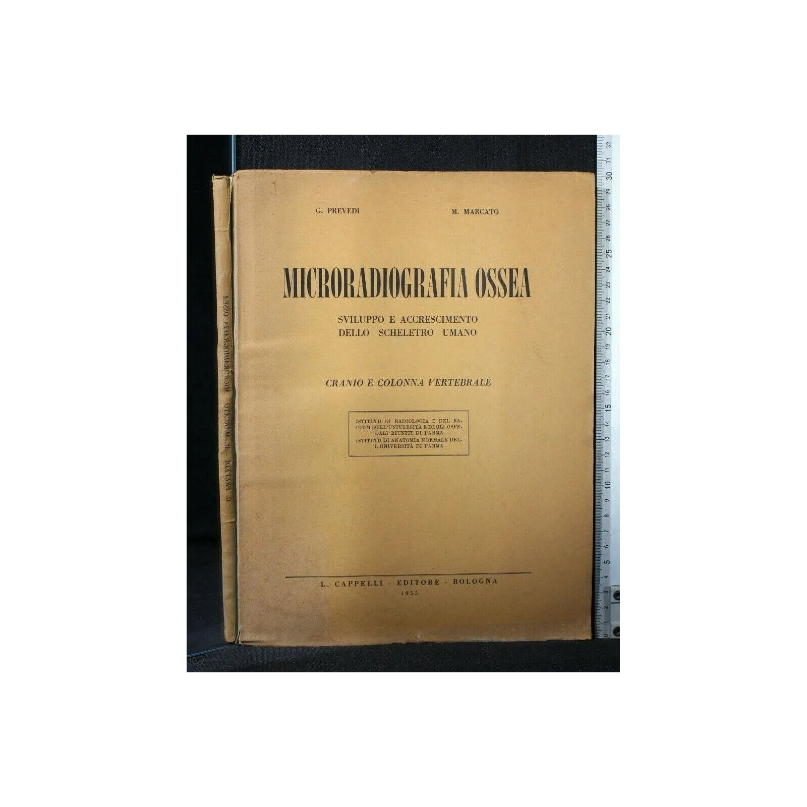 MICRORADIOGRAFIA OSSEA