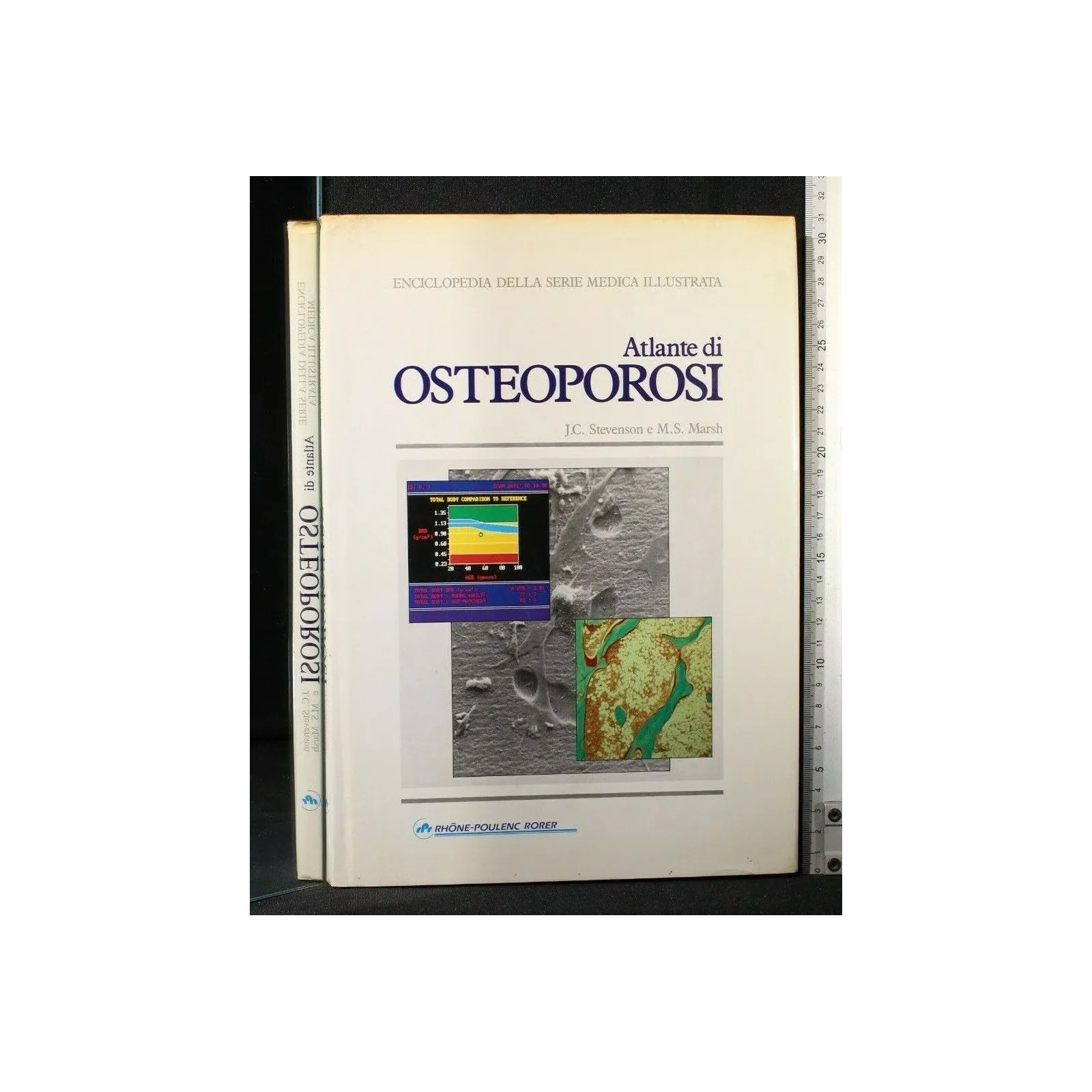 ATLANTE DI OSTEOPOROSI