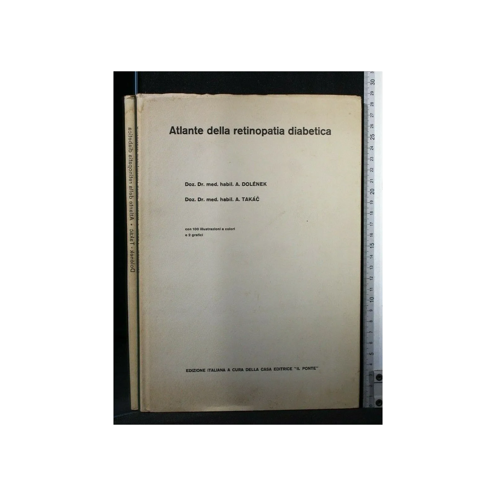 ATLANTE DELLA RETINOPATIA DIABETICA