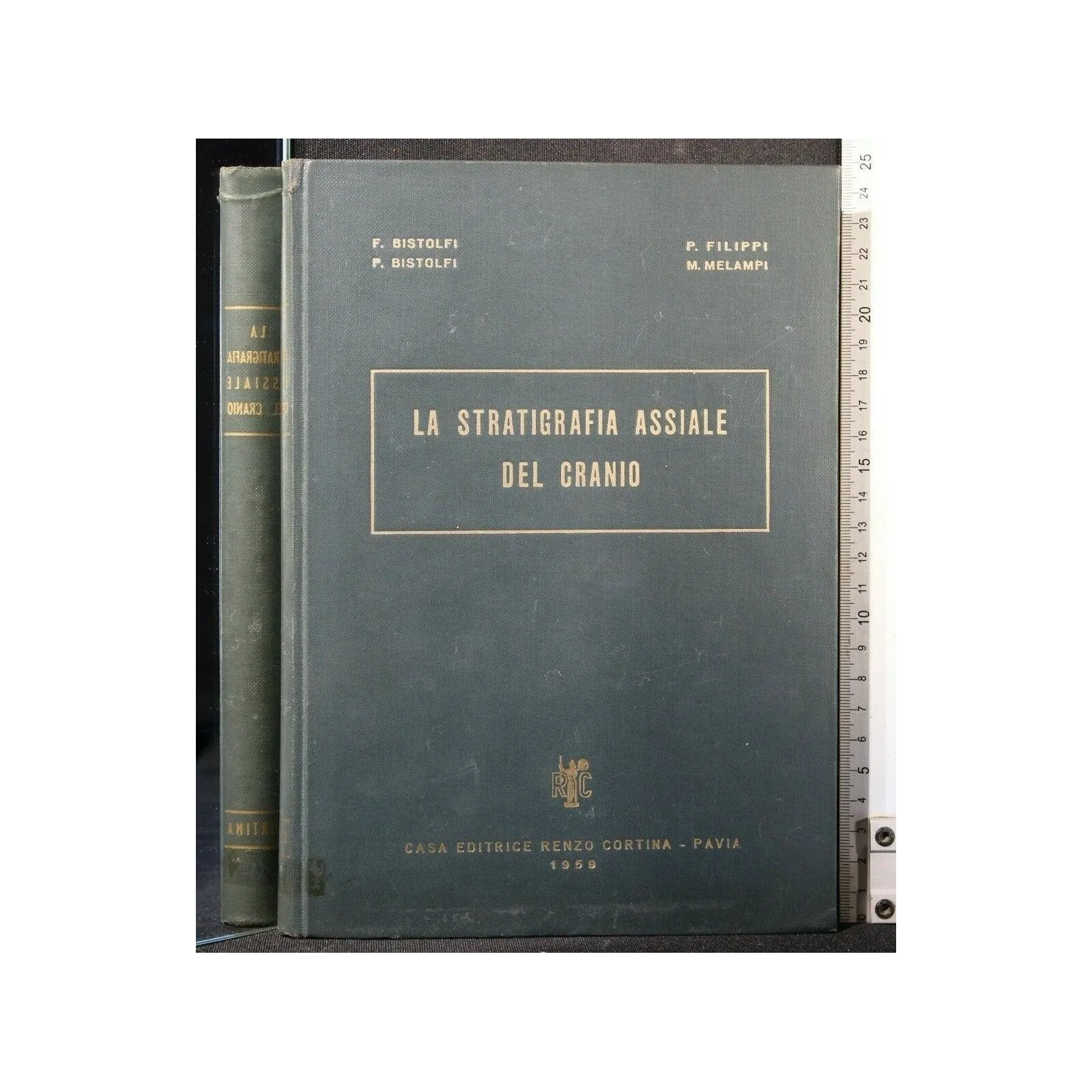 LA STRATIGRAFIA ASSIALE DEL CRANIO