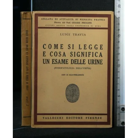 COME SI LEGGE E COSA SIGNIFICA UN ESAME DELLE URINE
