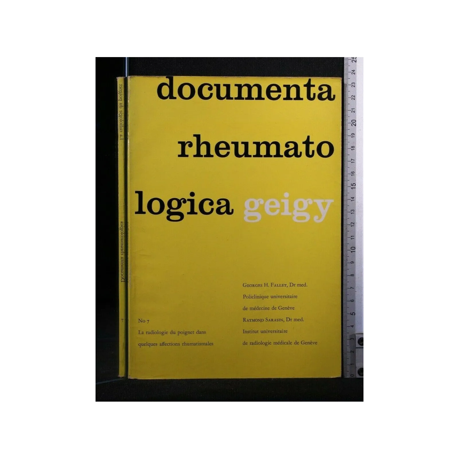 DOCUMENTA RHEUMATOLOGICA LA RADIOOGIE DU POIGNET DANS QUELQUES