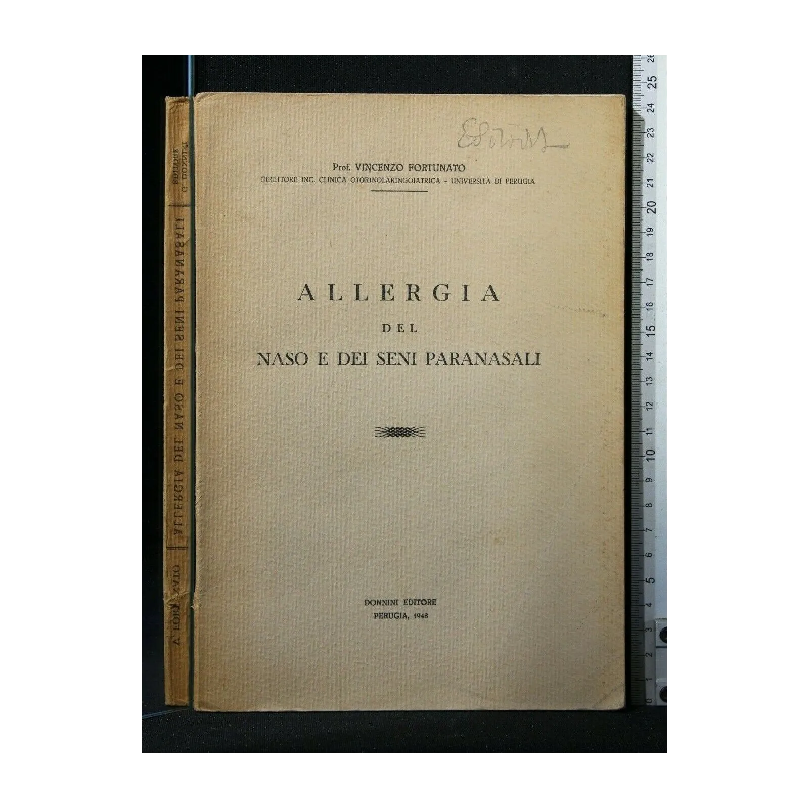 ALLERGIA DEL NASO E DEI SENI PARANASALI