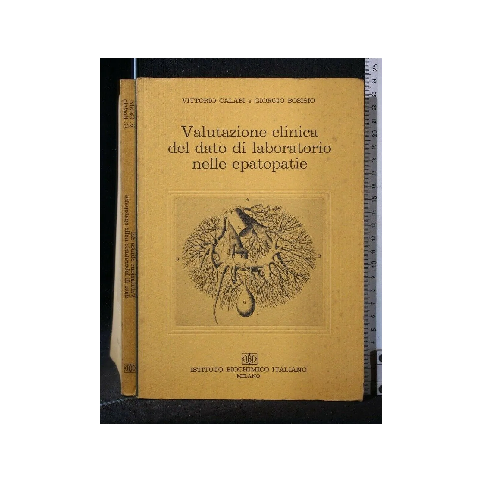 VALUTAZIONE CLINICA DEL DATO DI LABORATORIO NELLE EPATOPATIE