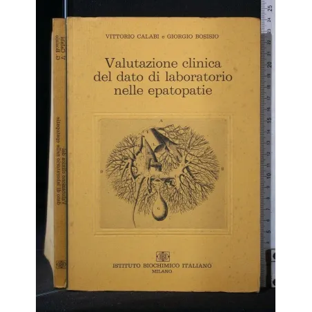 VALUTAZIONE CLINICA DEL DATO DI LABORATORIO NELLE EPATOPATIE