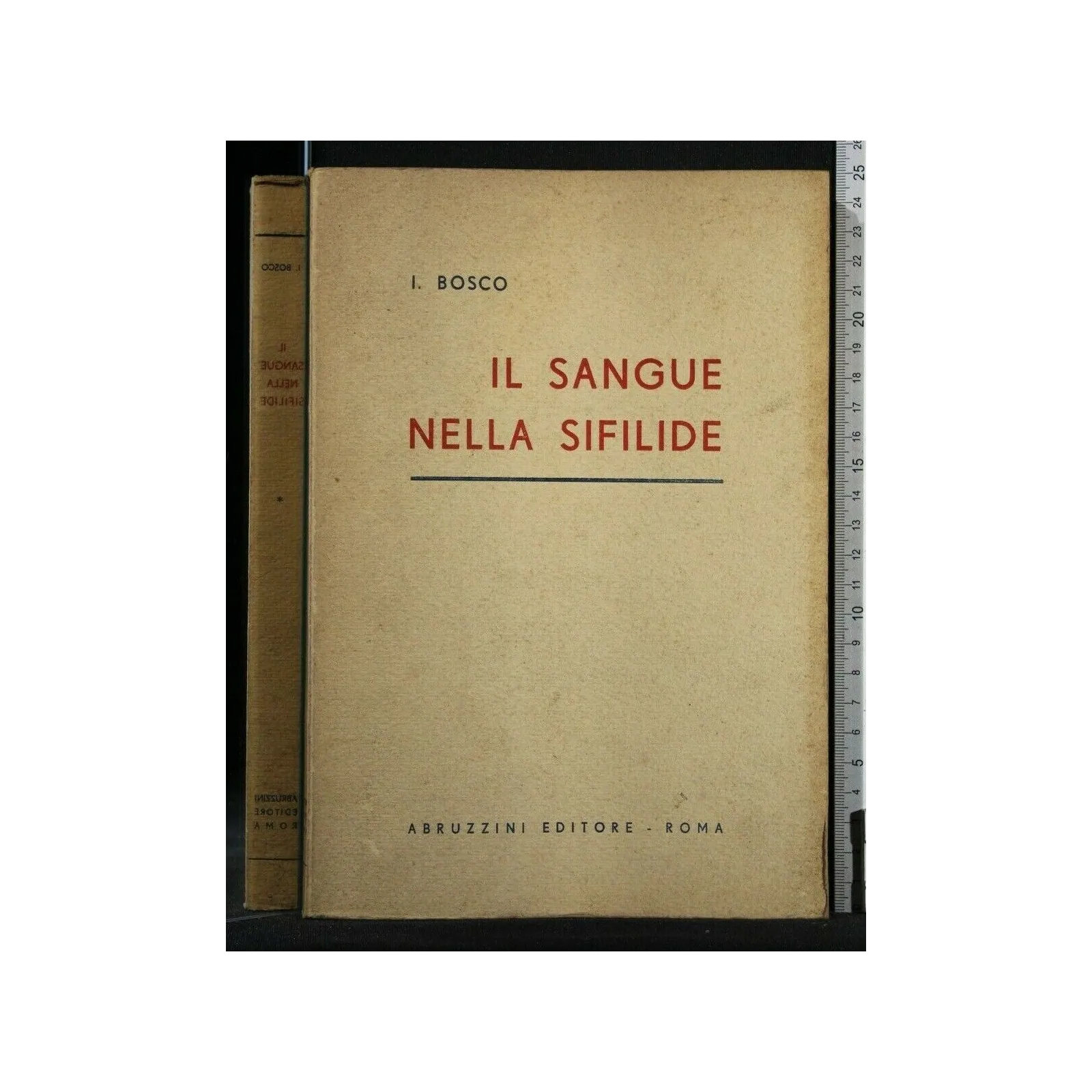 IL SANGUE NELLA SIFILIDE