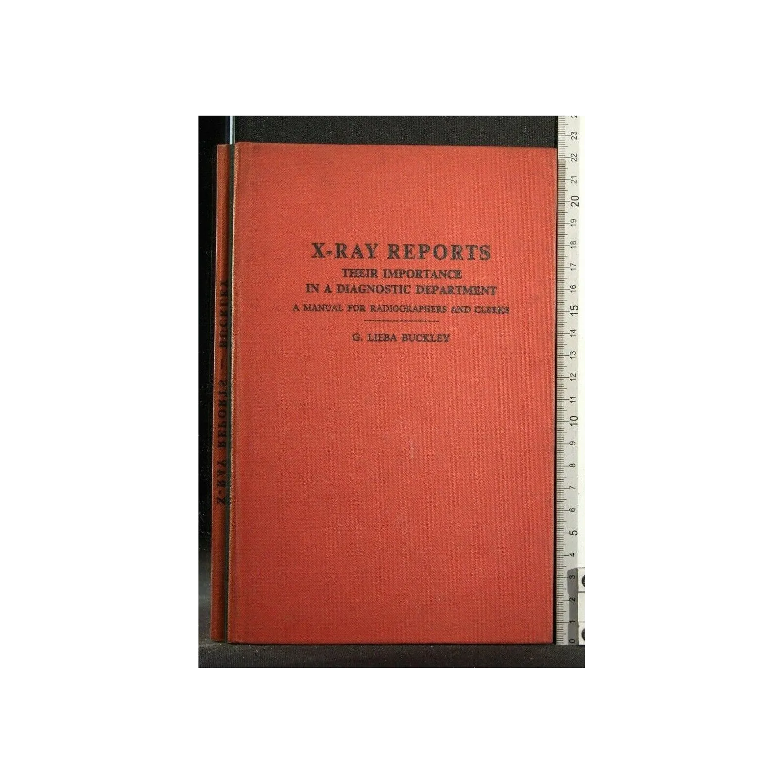 X-RAY REPORTS THEIR IMPORTANCE IN A DIAGNOSTIC DEPARTMENT