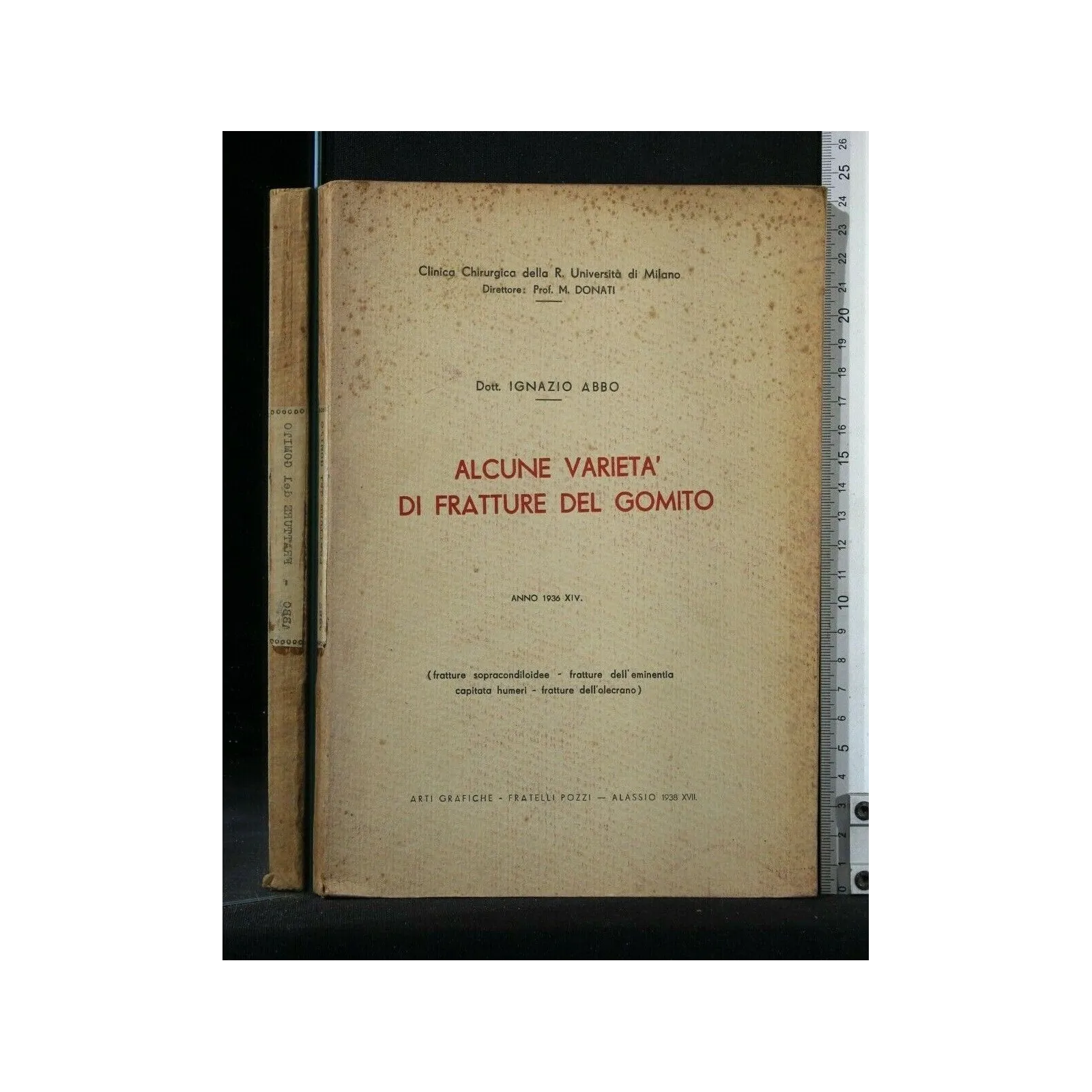ALCUNE VARIETA' DI FRATTURE DEL GOMITO ANNO 1936